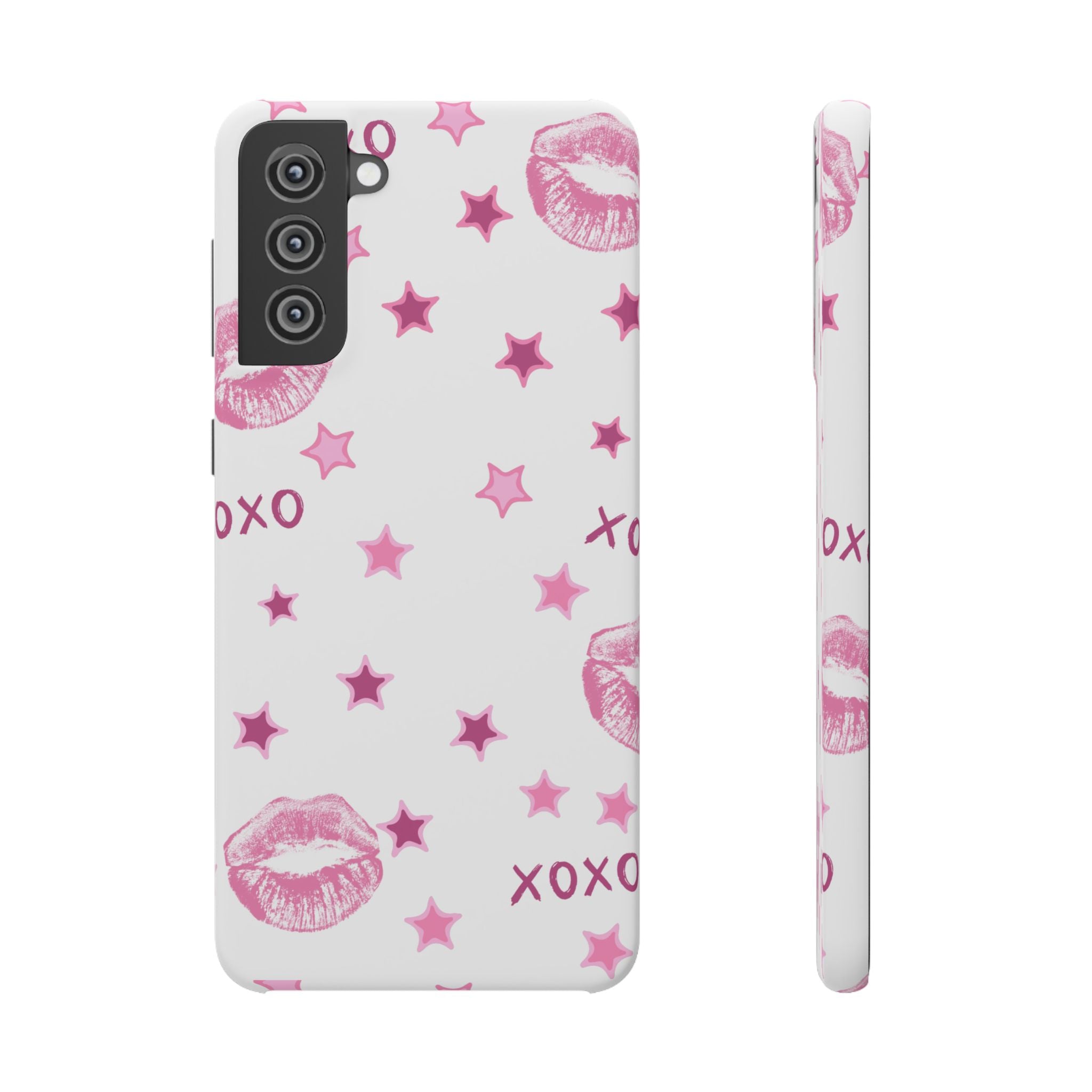 Kisses & Stars Snap Phone Case 💋