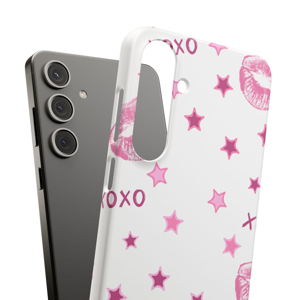 Kisses & Stars Snap Phone Case 💋