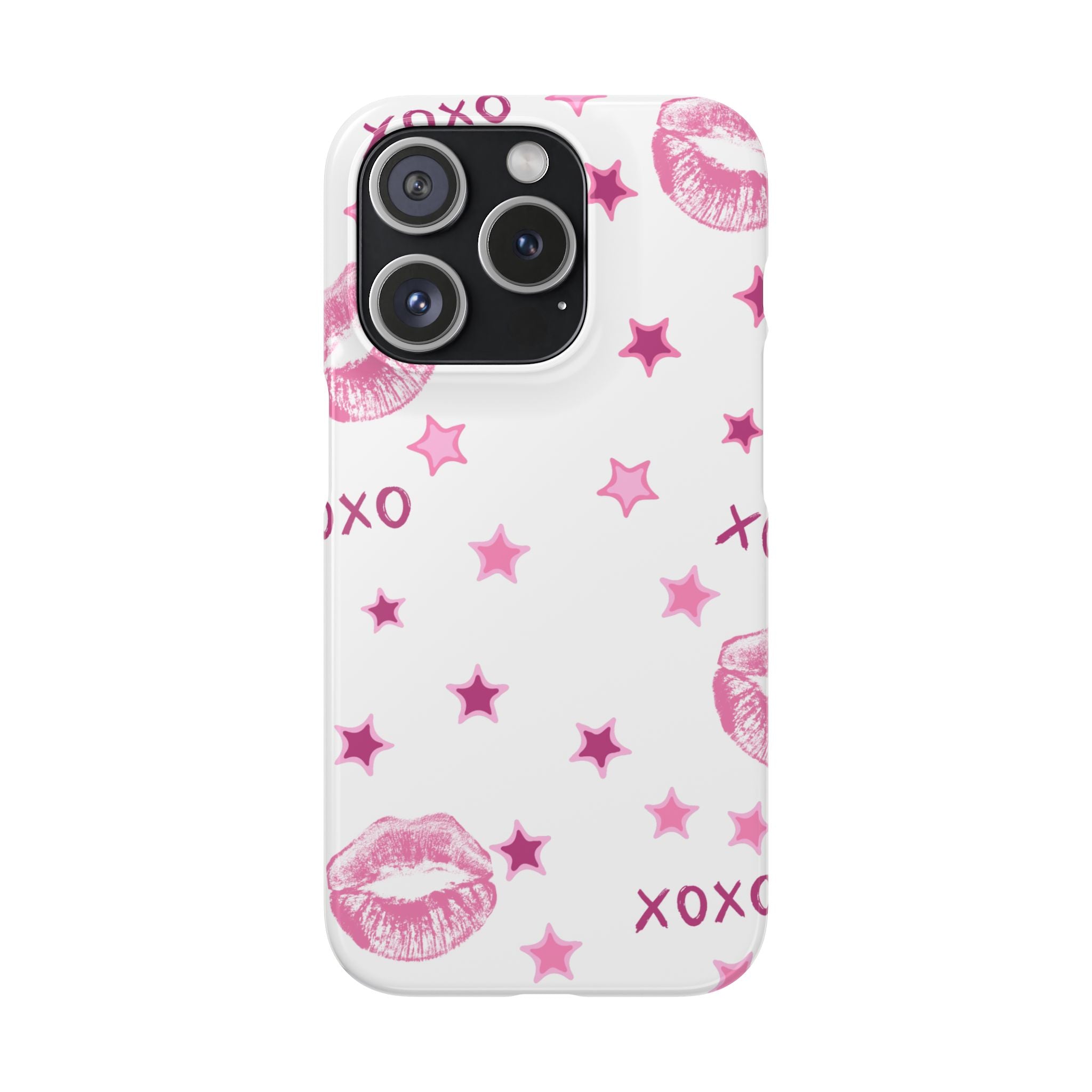 Kisses & Stars Snap Phone Case 💋