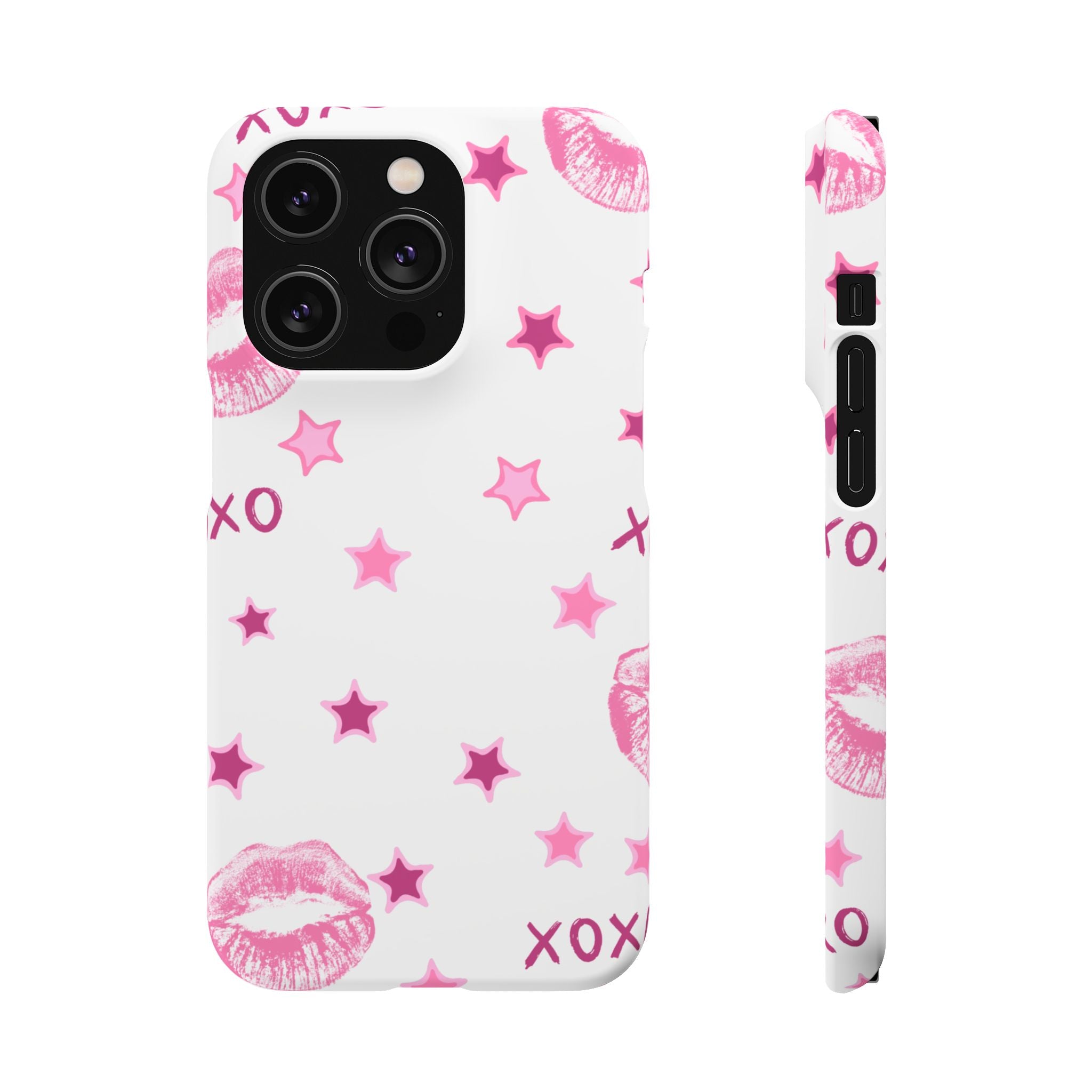 Kisses & Stars Snap Phone Case 💋