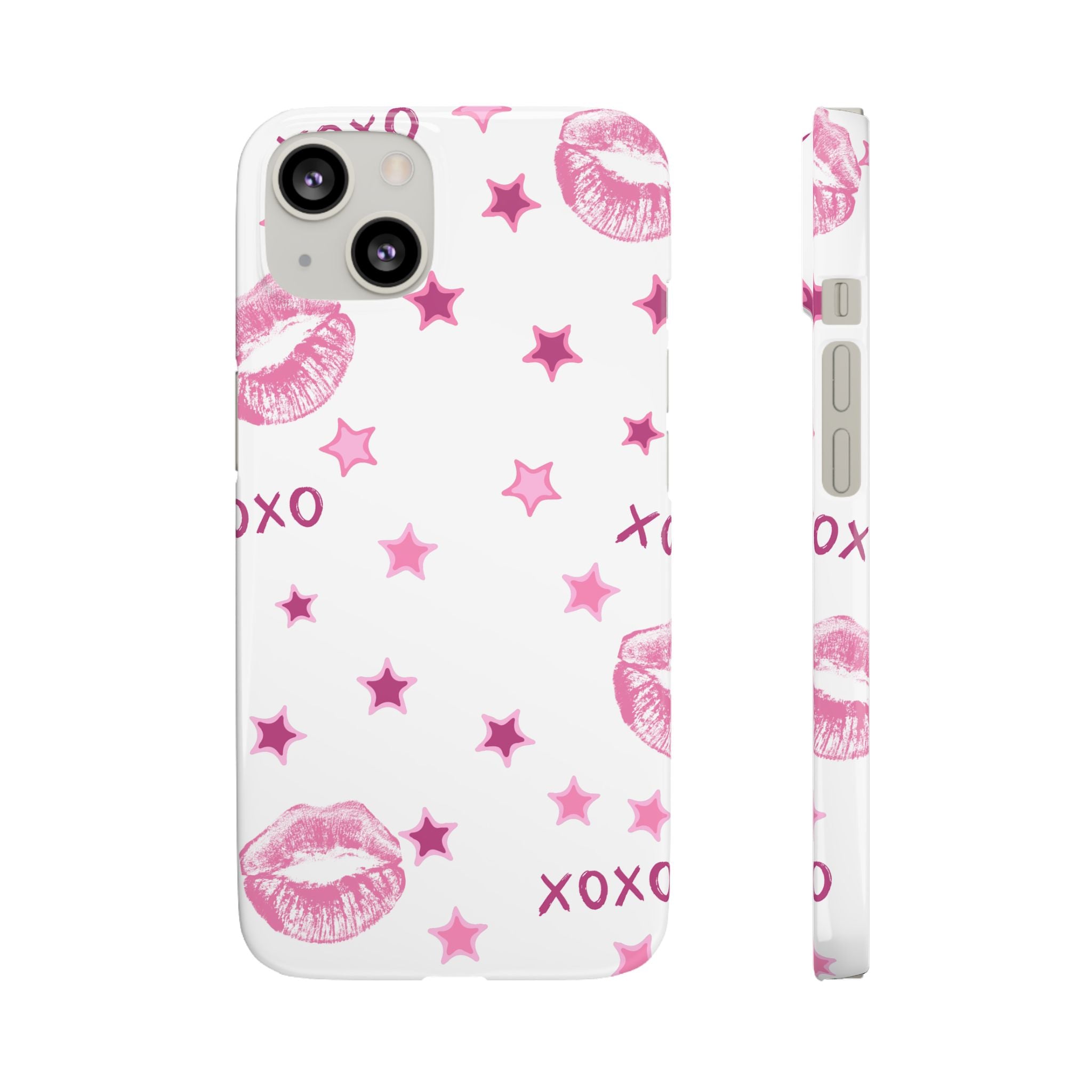 Kisses & Stars Snap Phone Case 💋