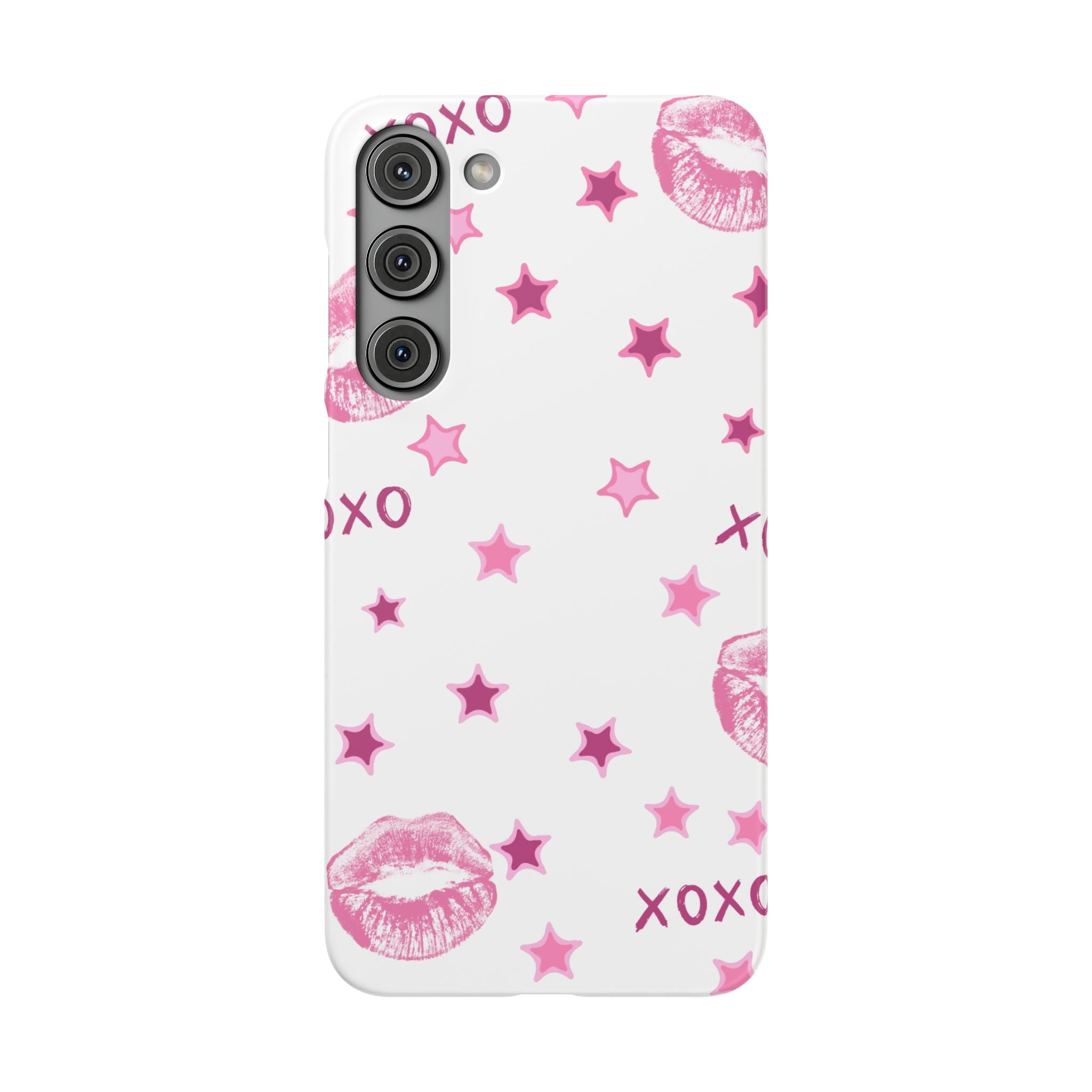 Kisses & Stars Snap Phone Case 💋