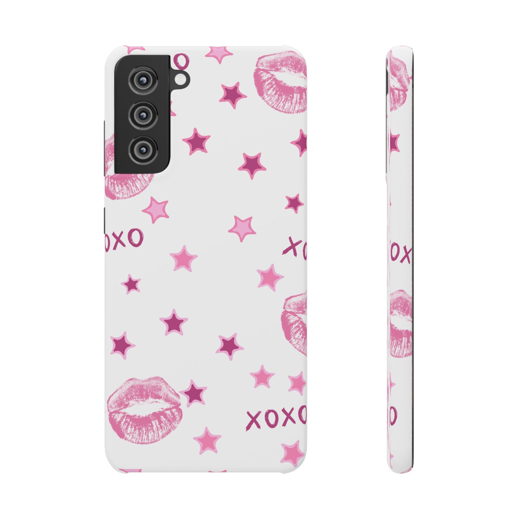Kisses & Stars Snap Phone Case 💋