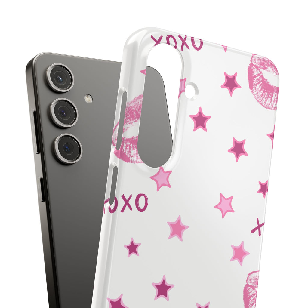 Kisses & Stars Snap Phone Case 💋