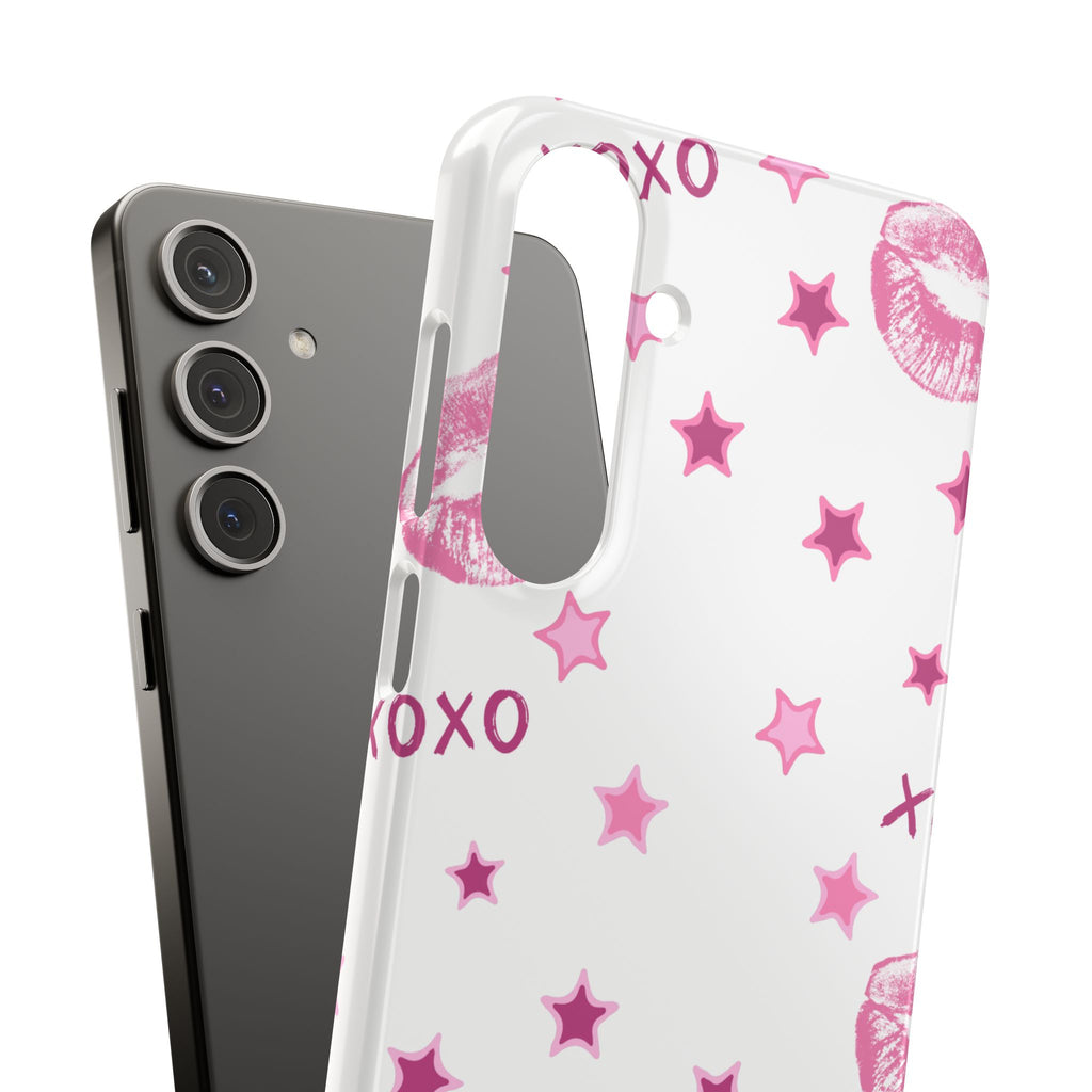 Kisses & Stars Snap Phone Case 💋