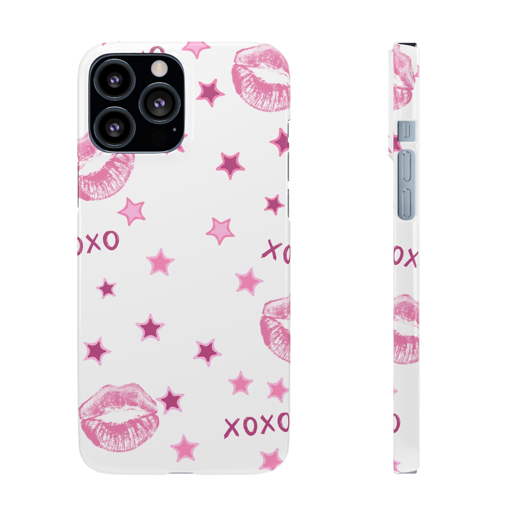 Kisses & Stars Snap Phone Case 💋