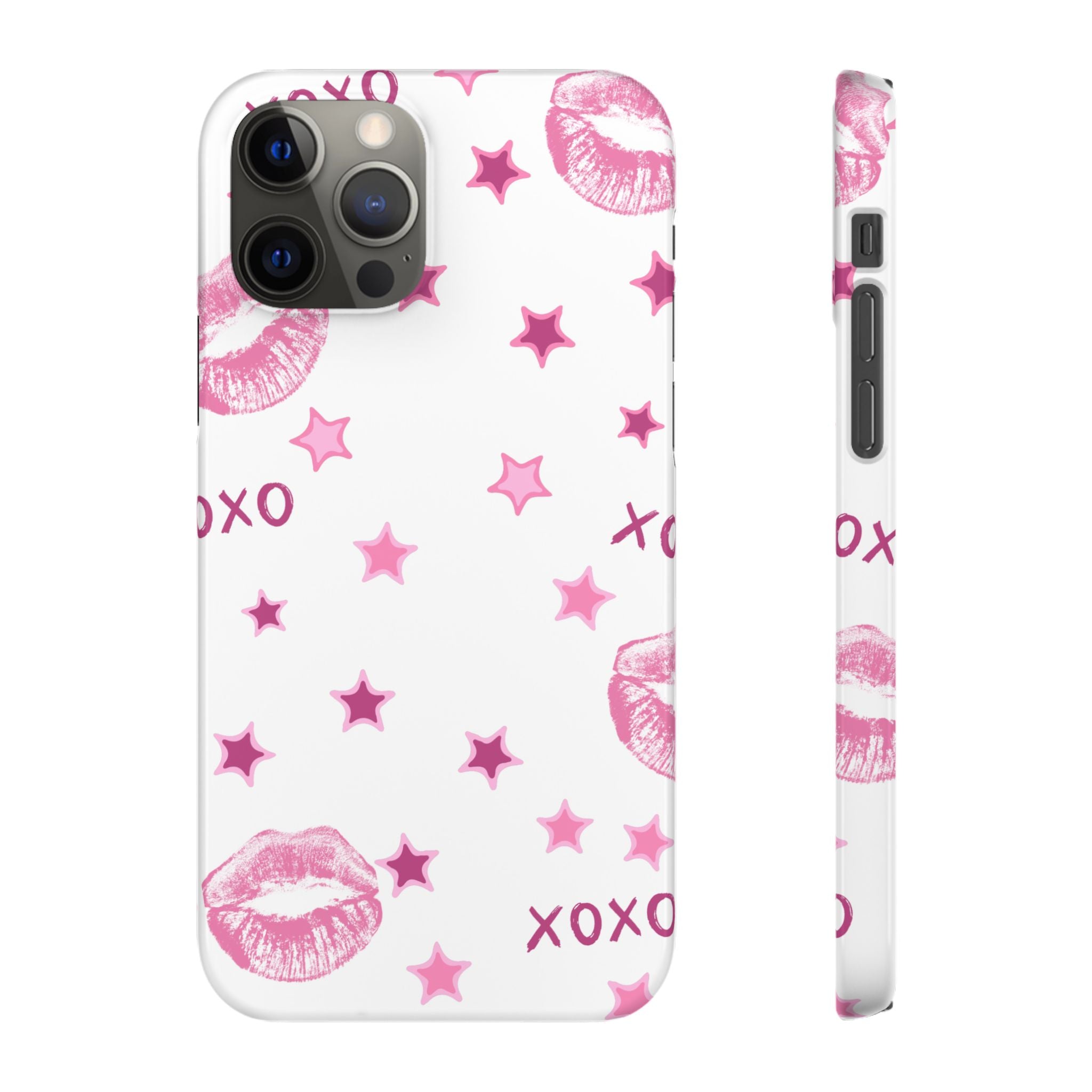 Kisses & Stars Snap Phone Case 💋