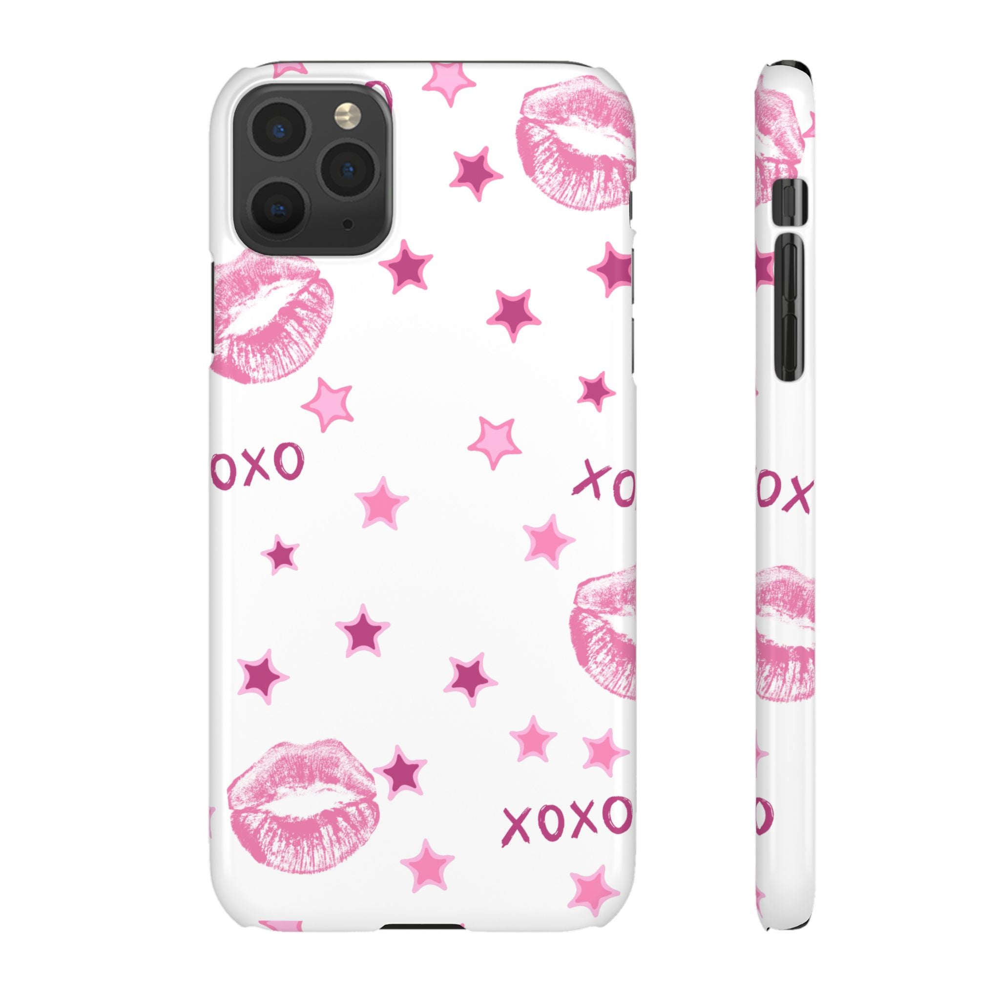 Kisses & Stars Snap Phone Case 💋