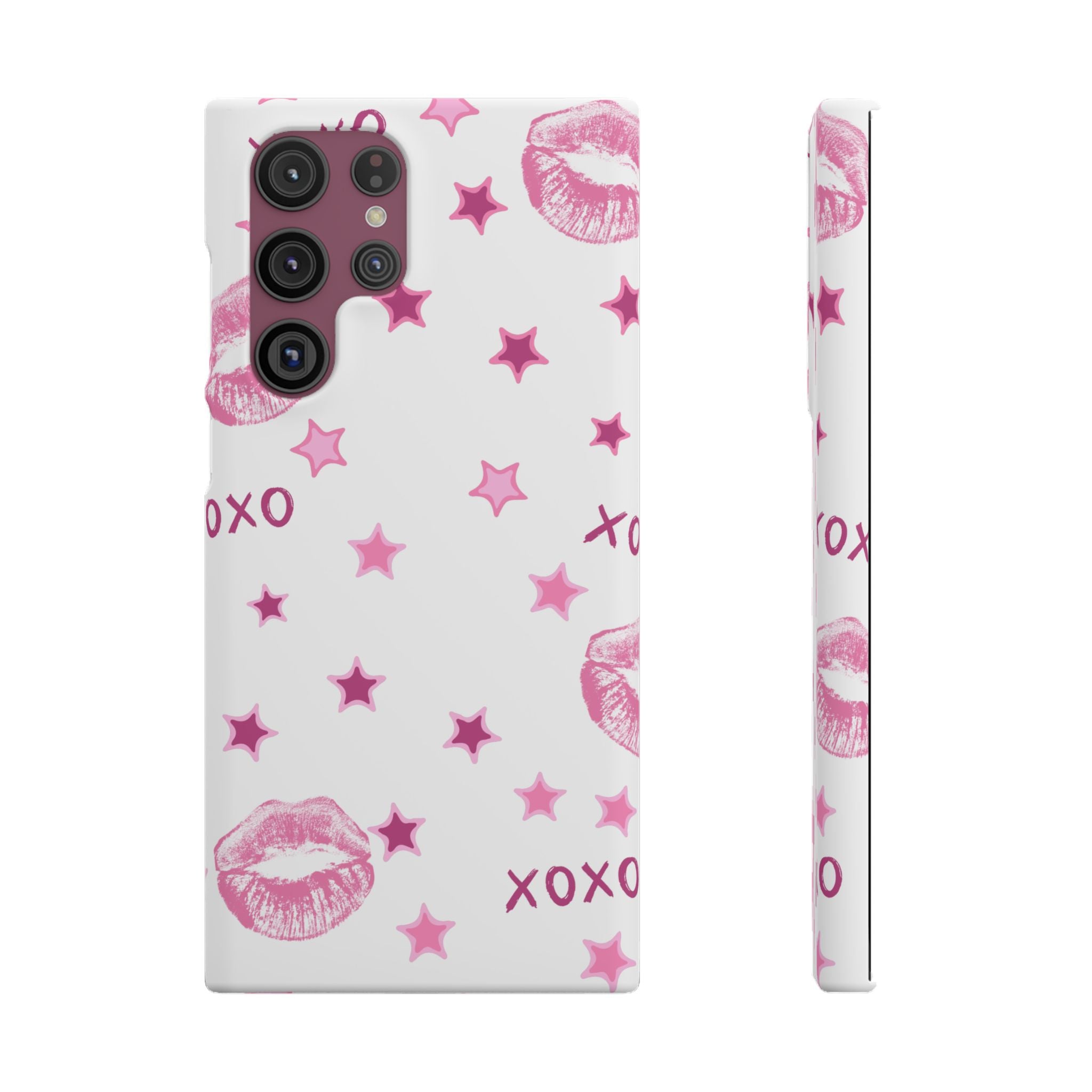 Kisses & Stars Snap Phone Case 💋