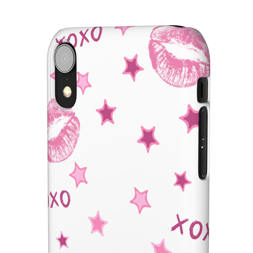 Kisses & Stars Snap Phone Case 💋