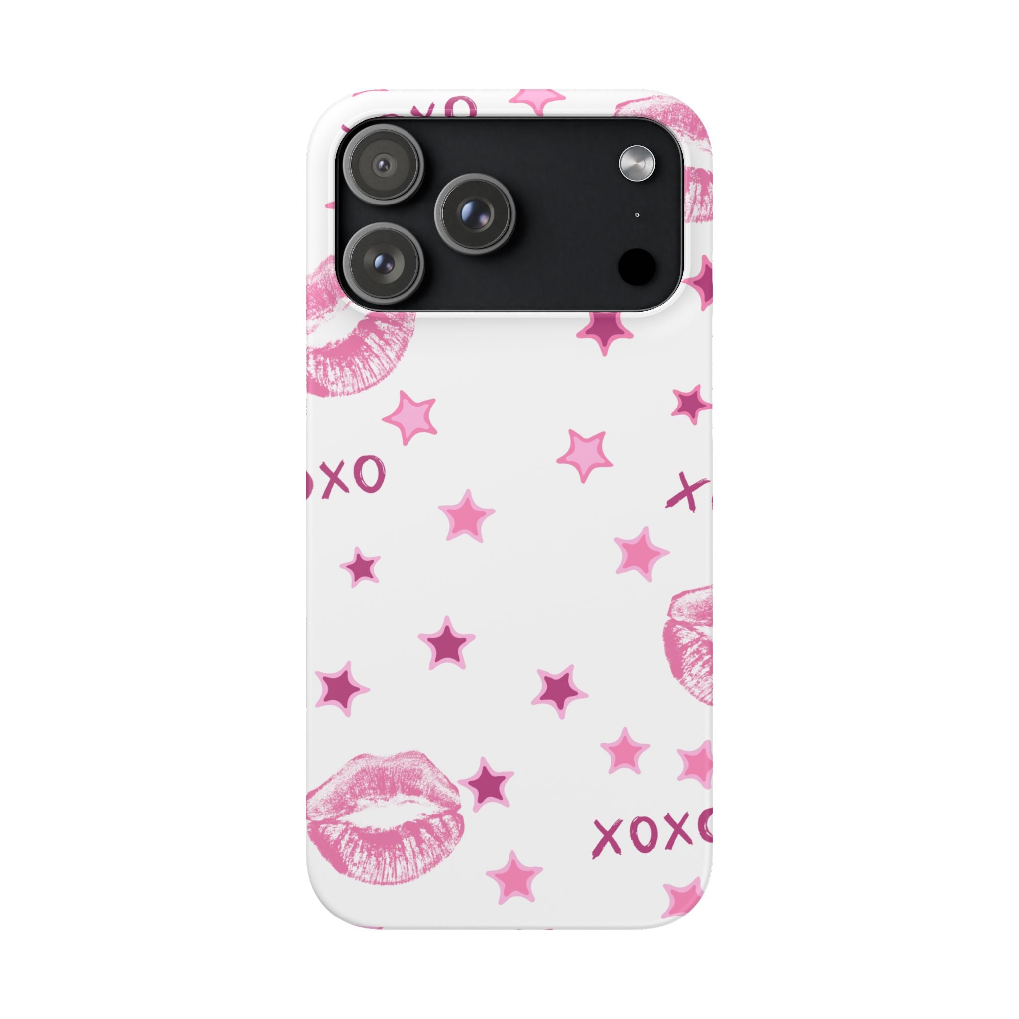 Kisses & Stars Snap Phone Case 💋