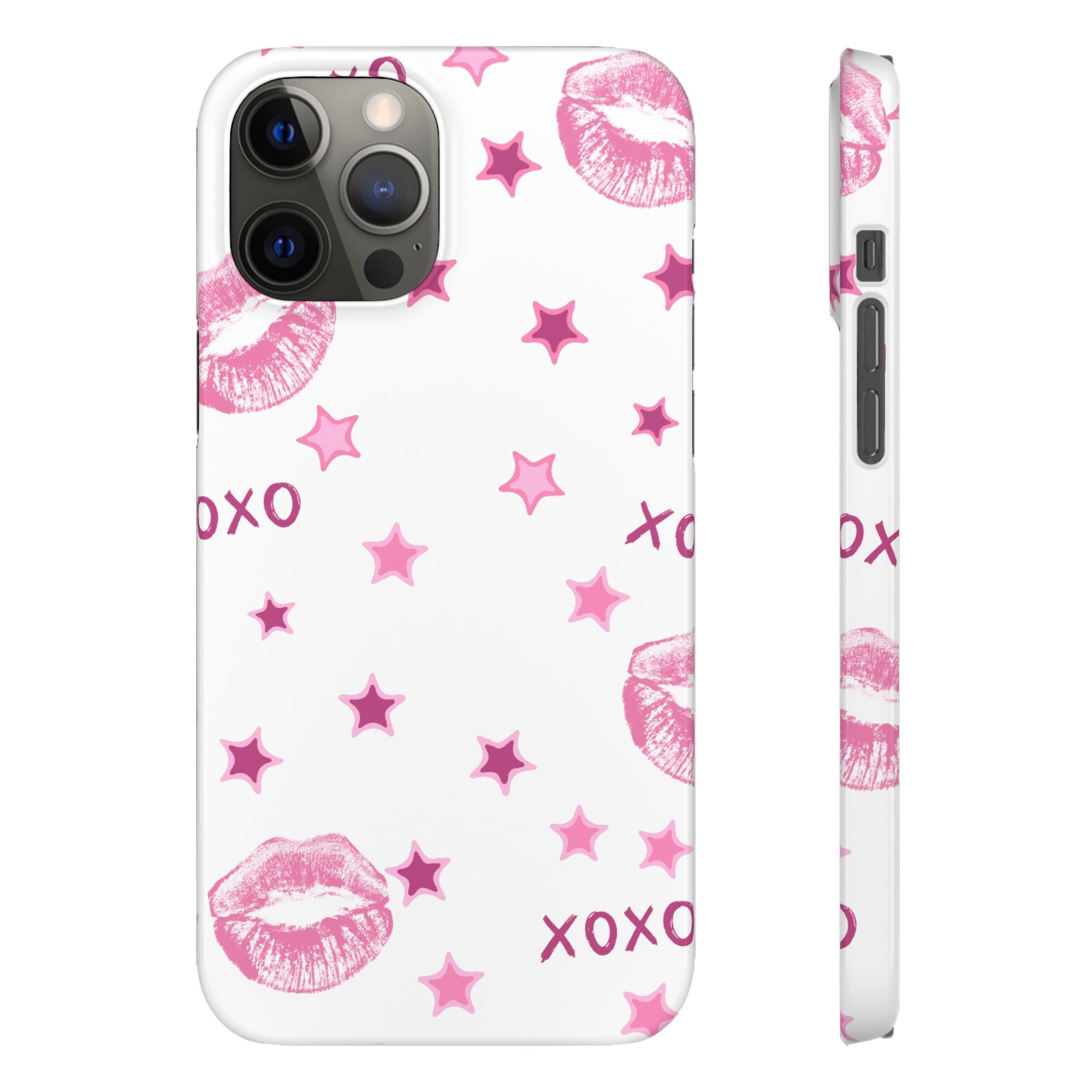 Kisses & Stars Snap Phone Case 💋