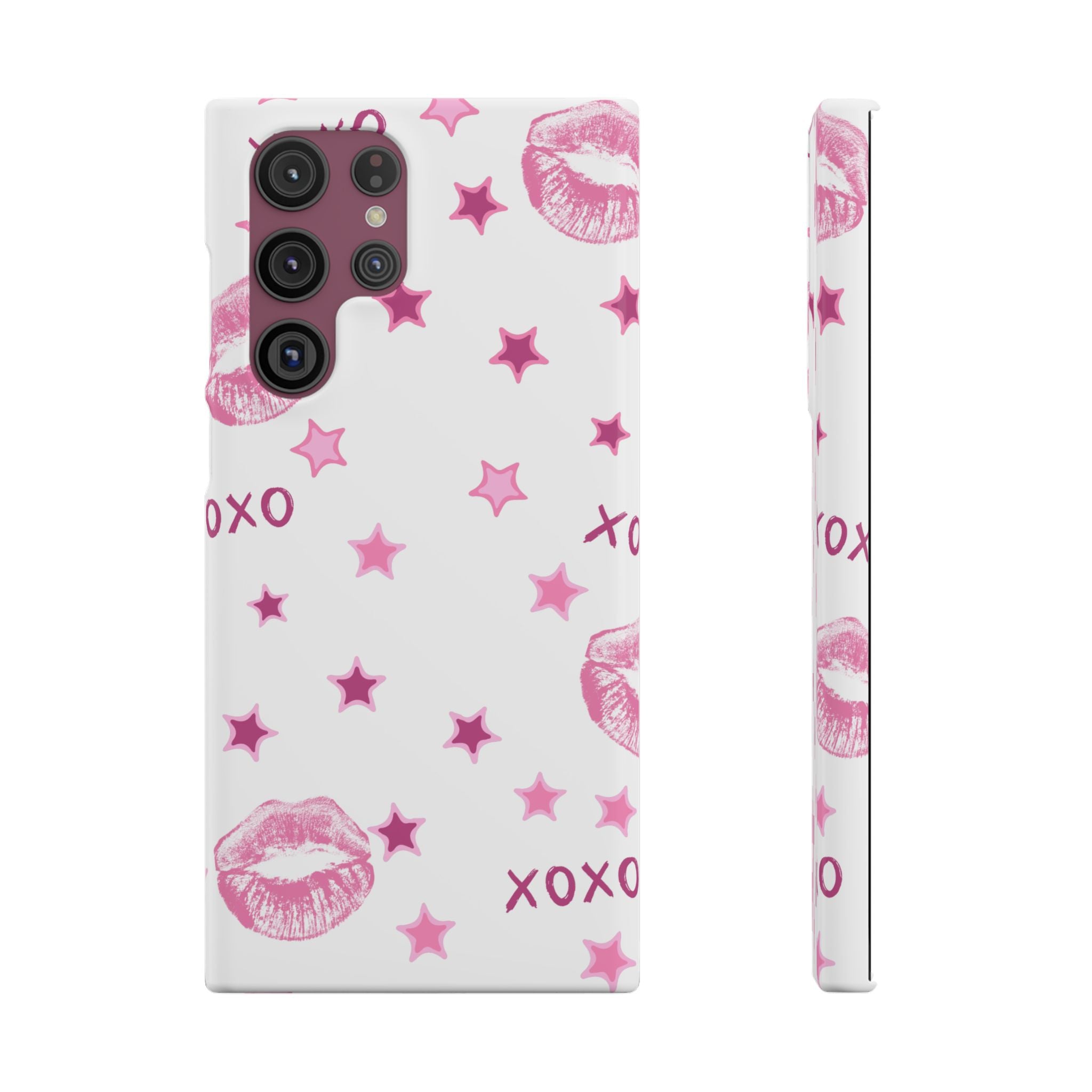 Kisses & Stars Snap Phone Case 💋