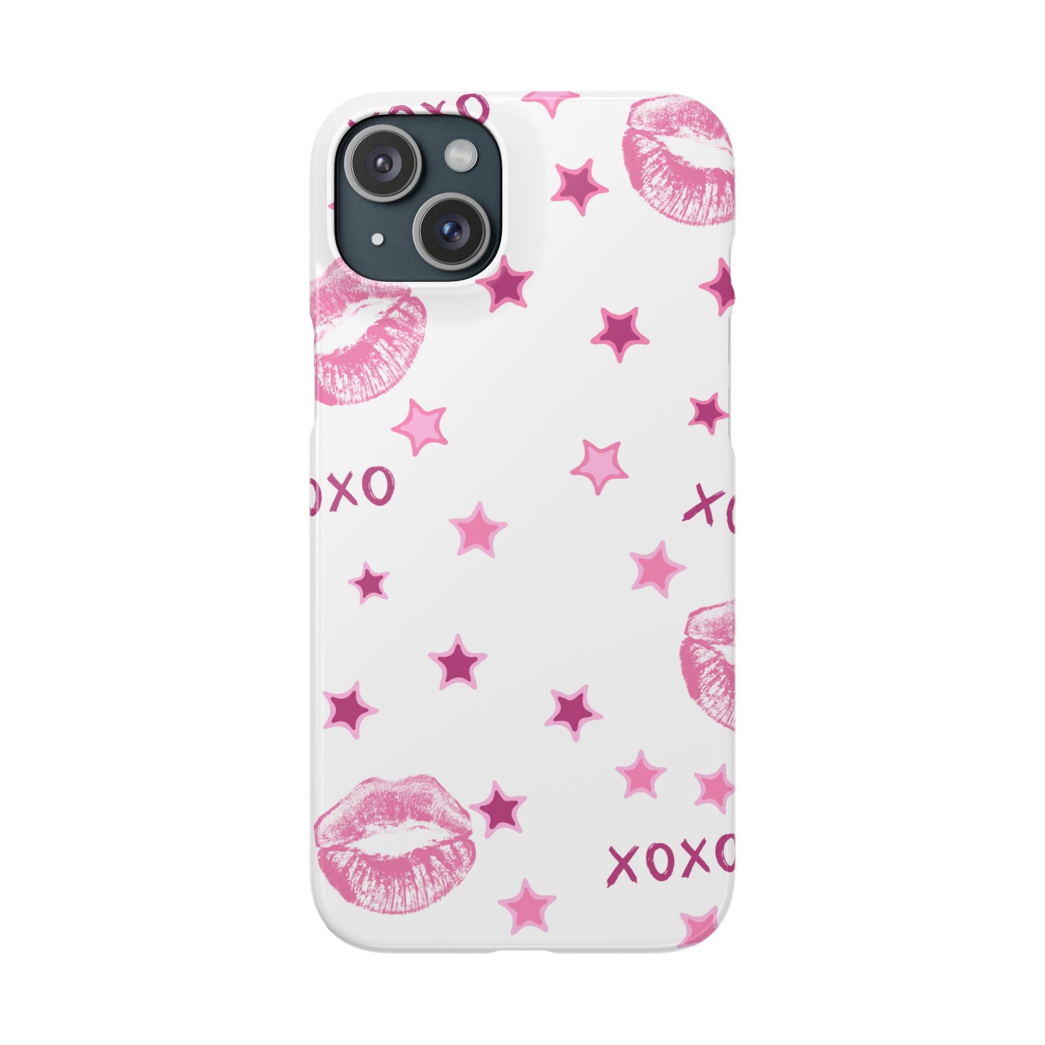 Kisses & Stars Snap Phone Case 💋