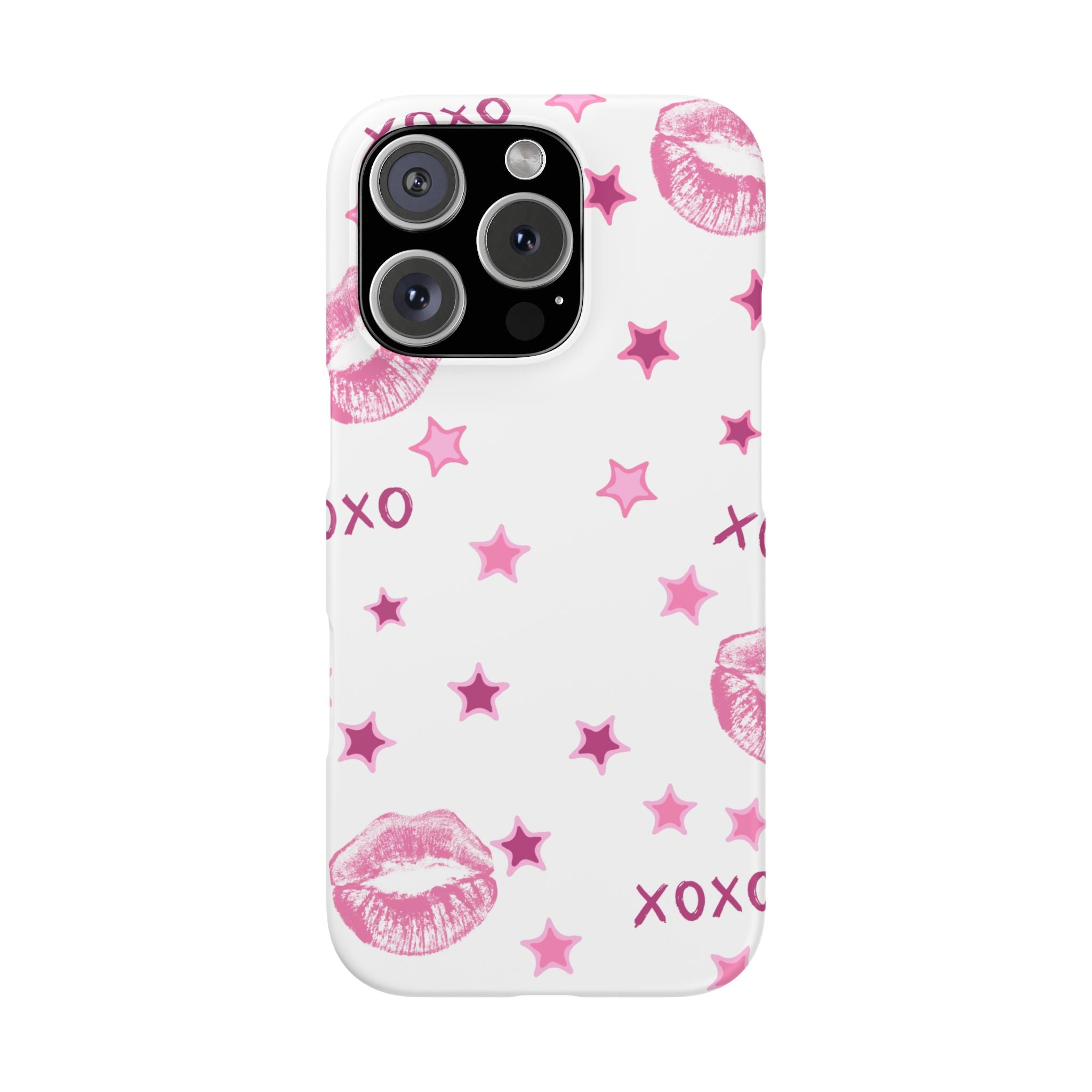 Kisses & Stars Snap Phone Case 💋