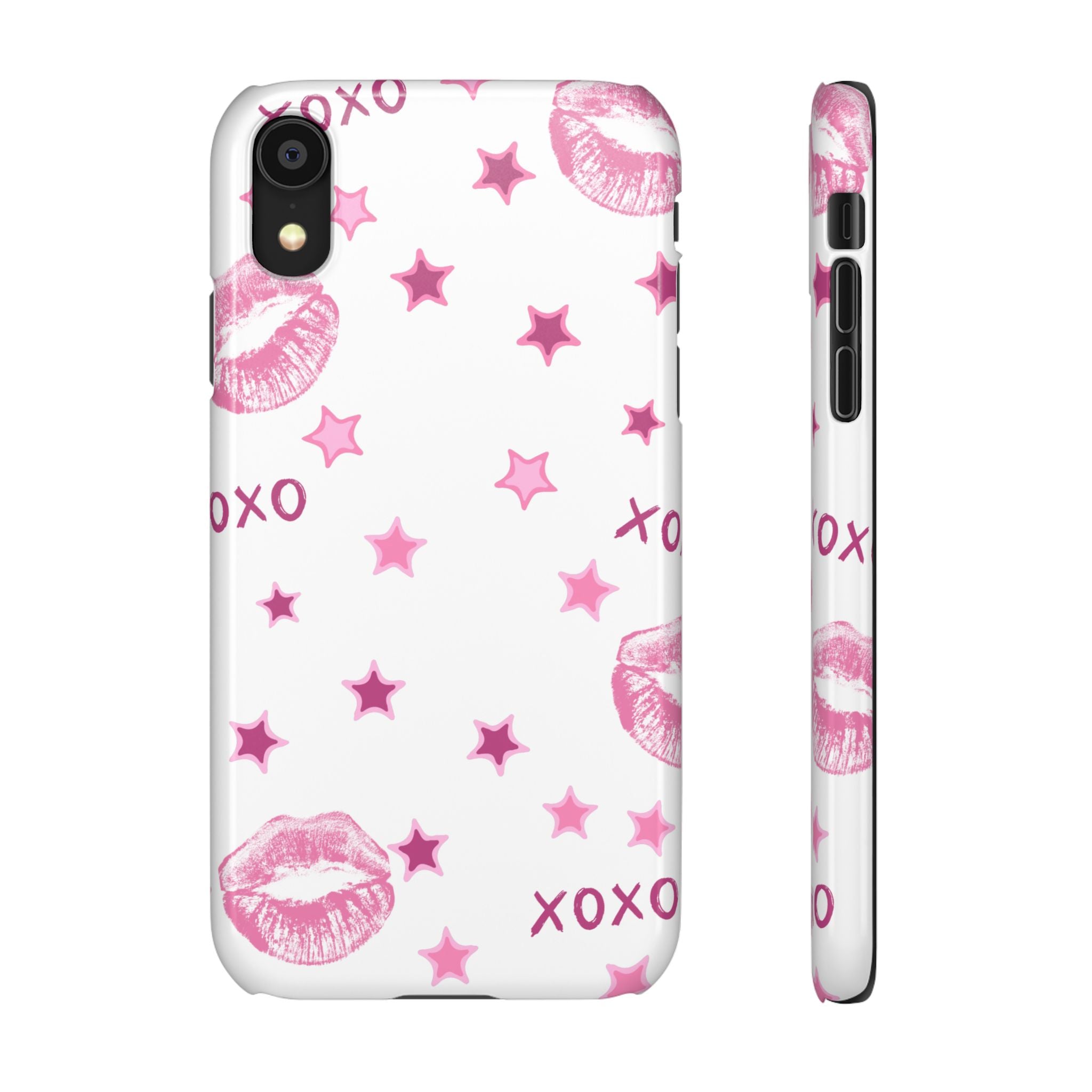 Kisses & Stars Snap Phone Case 💋