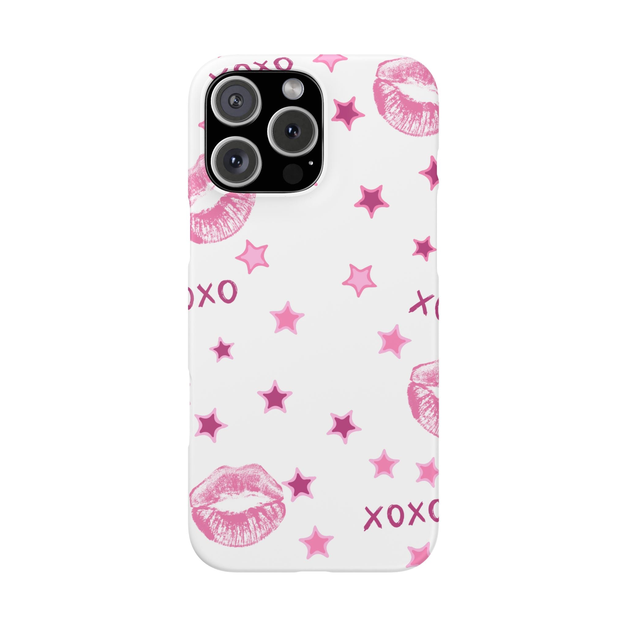 Kisses & Stars Snap Phone Case 💋