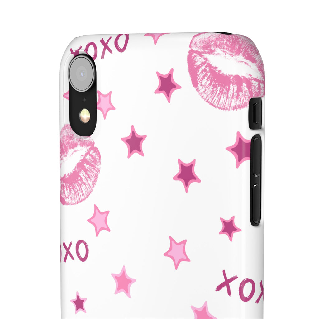 Kisses & Stars Snap Phone Case 💋