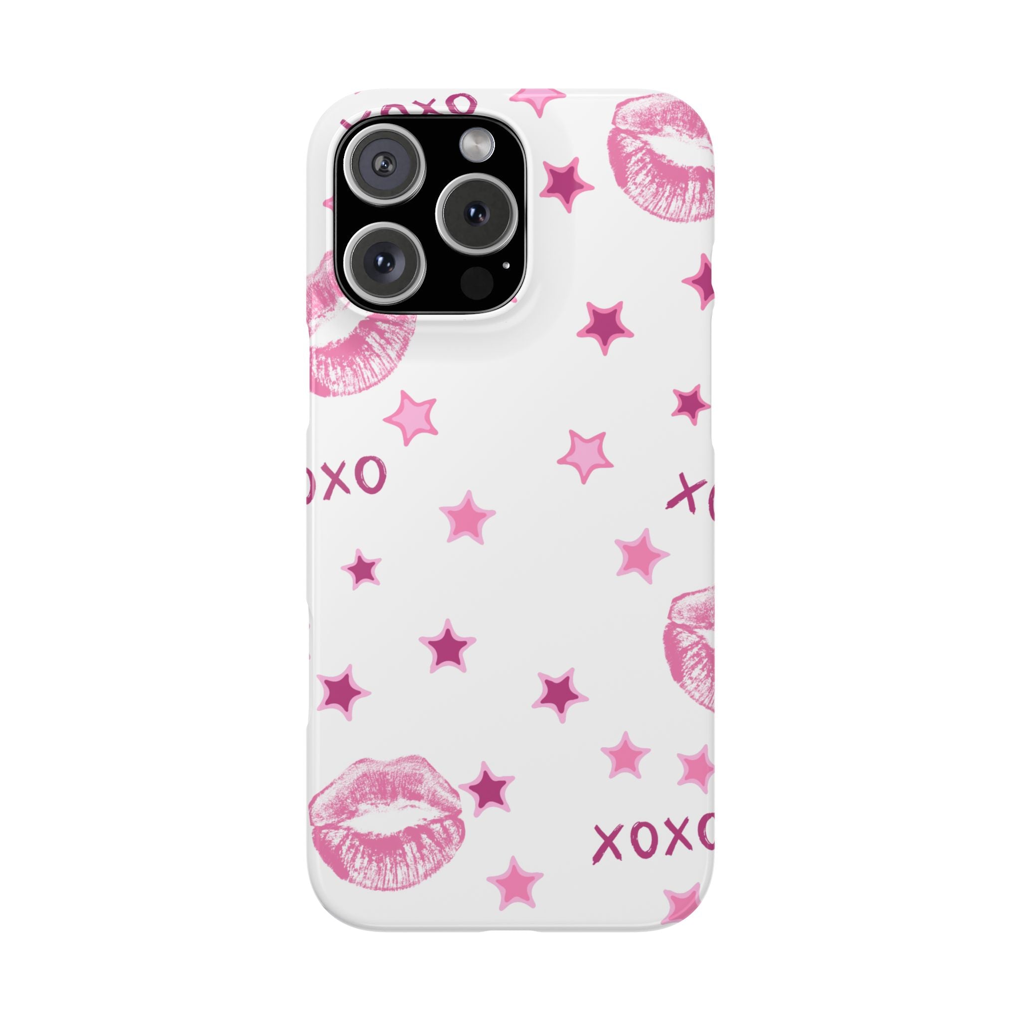 Kisses & Stars Snap Phone Case 💋