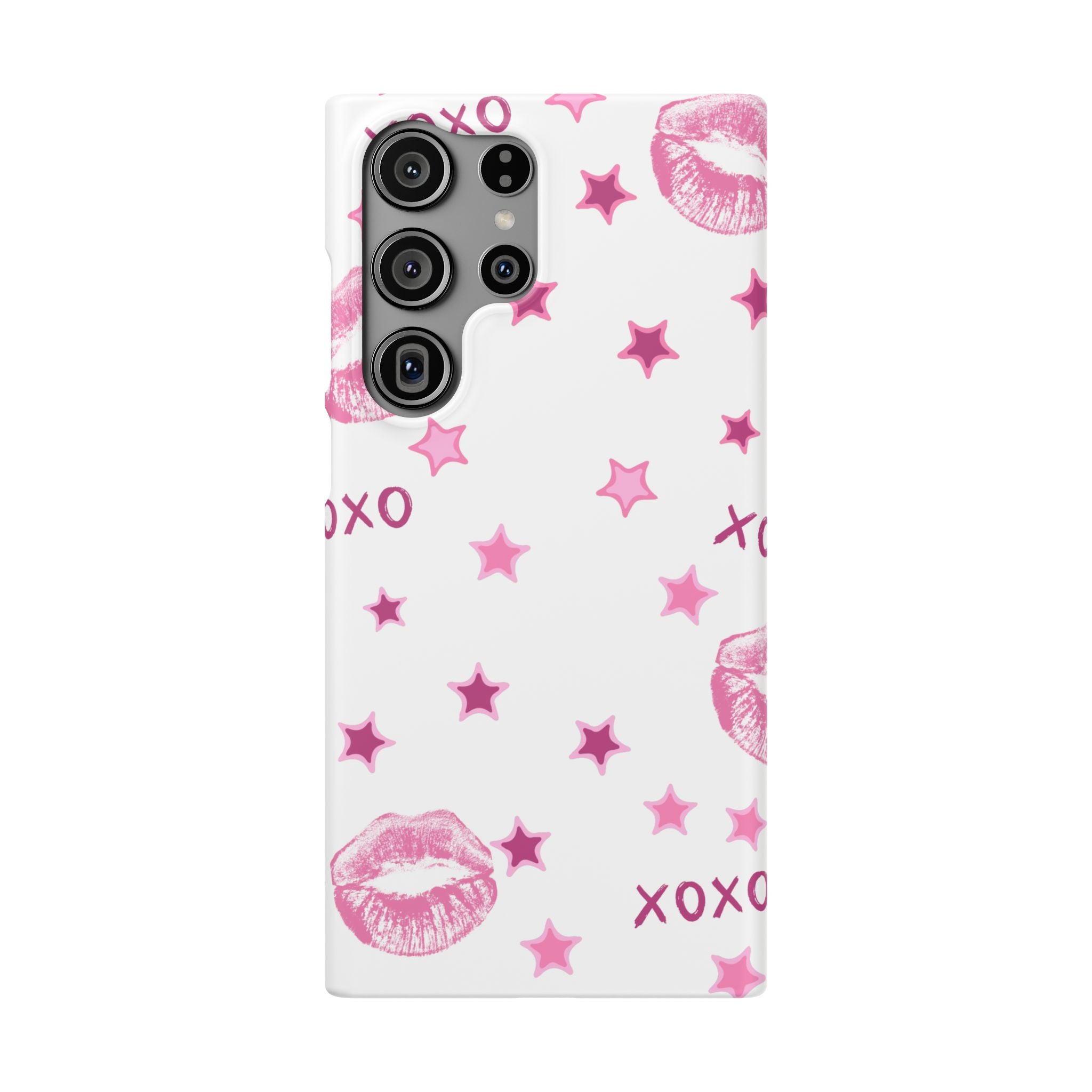Kisses & Stars Snap Phone Case 💋