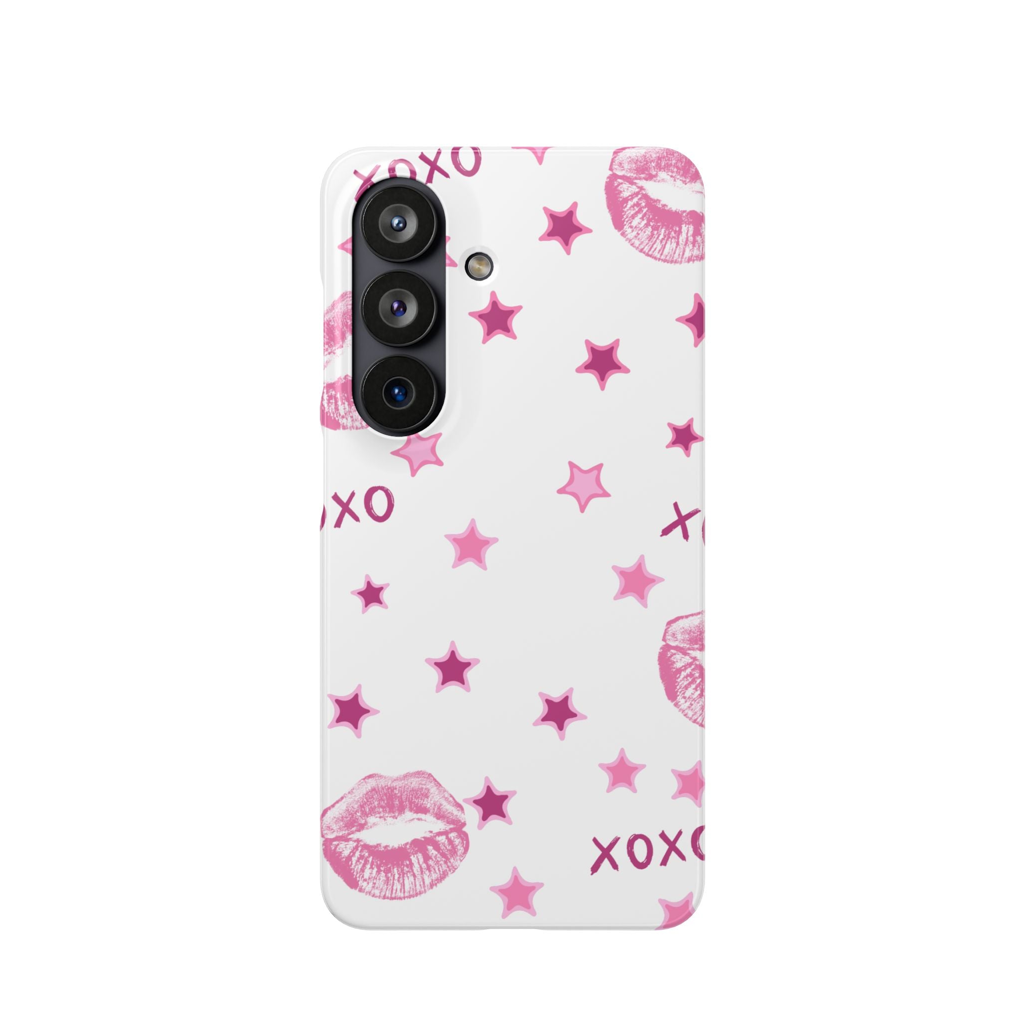 Kisses & Stars Snap Phone Case 💋