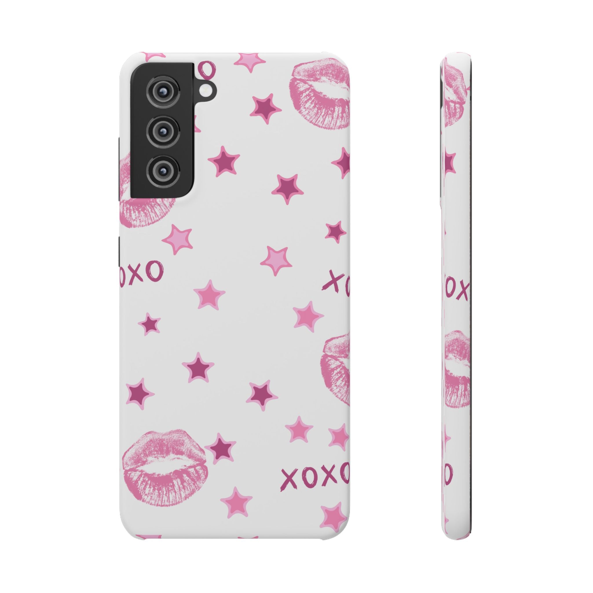 Kisses & Stars Snap Phone Case 💋