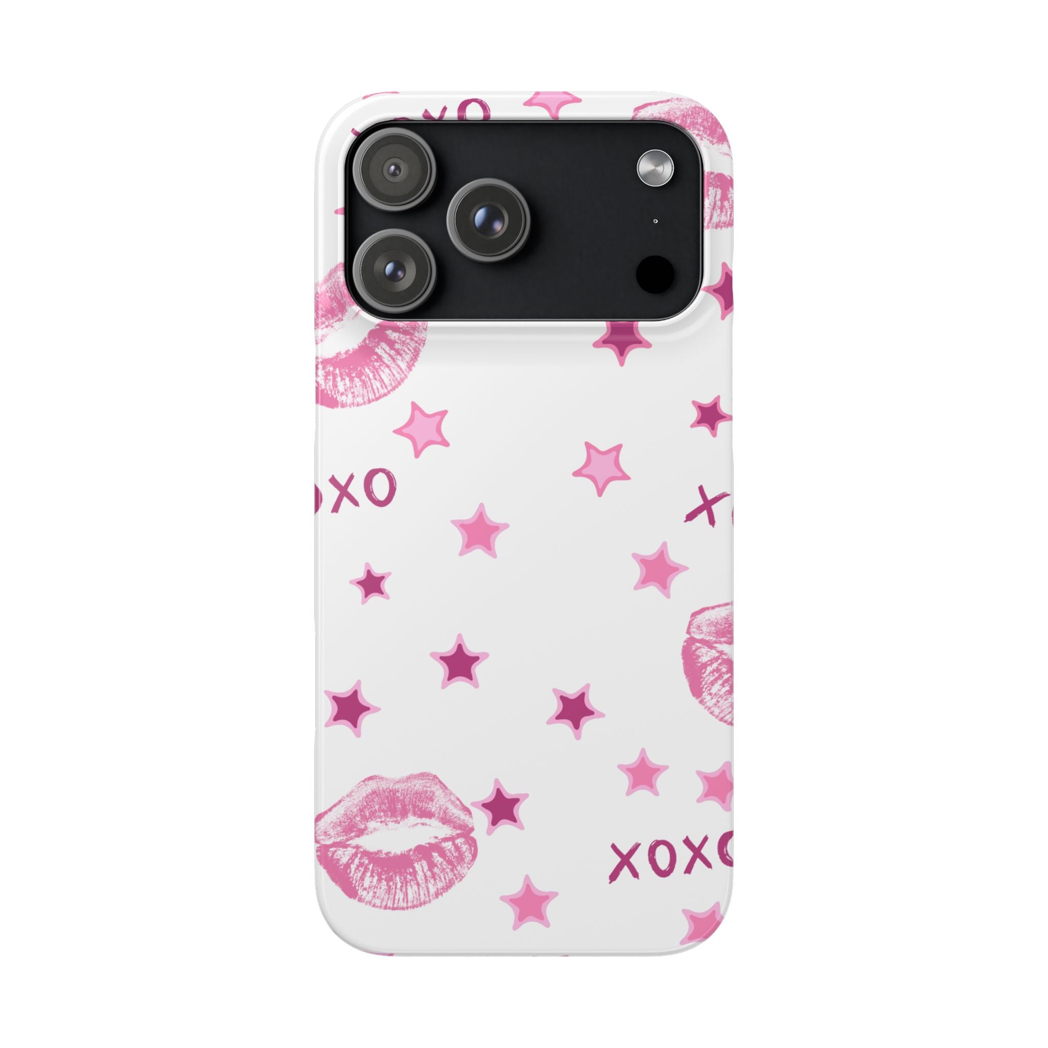 Kisses & Stars Snap Phone Case 💋
