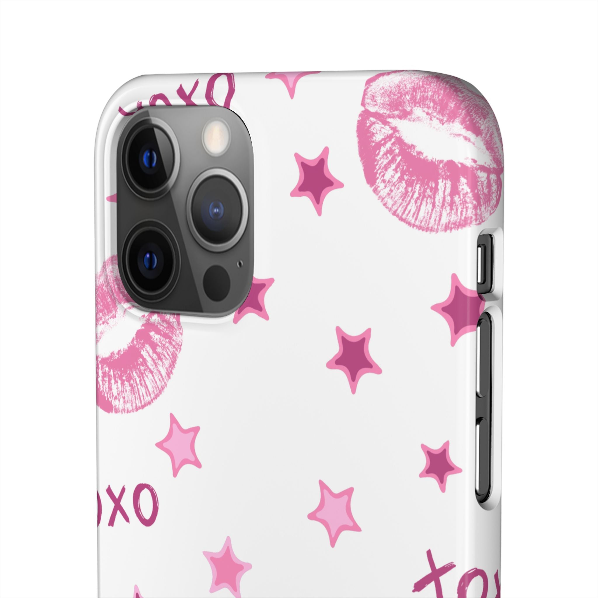 Kisses & Stars Snap Phone Case 💋