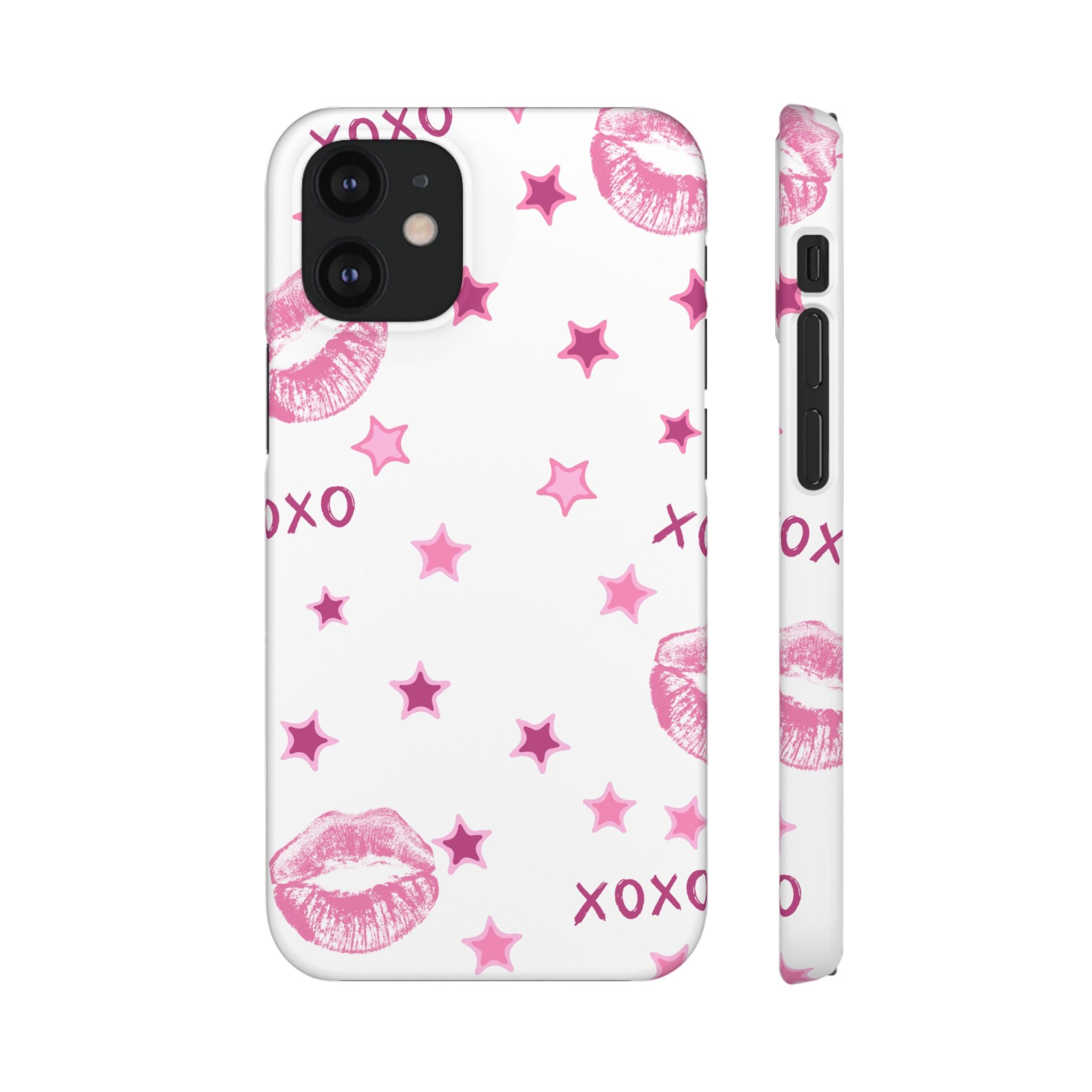 Kisses & Stars Snap Phone Case 💋