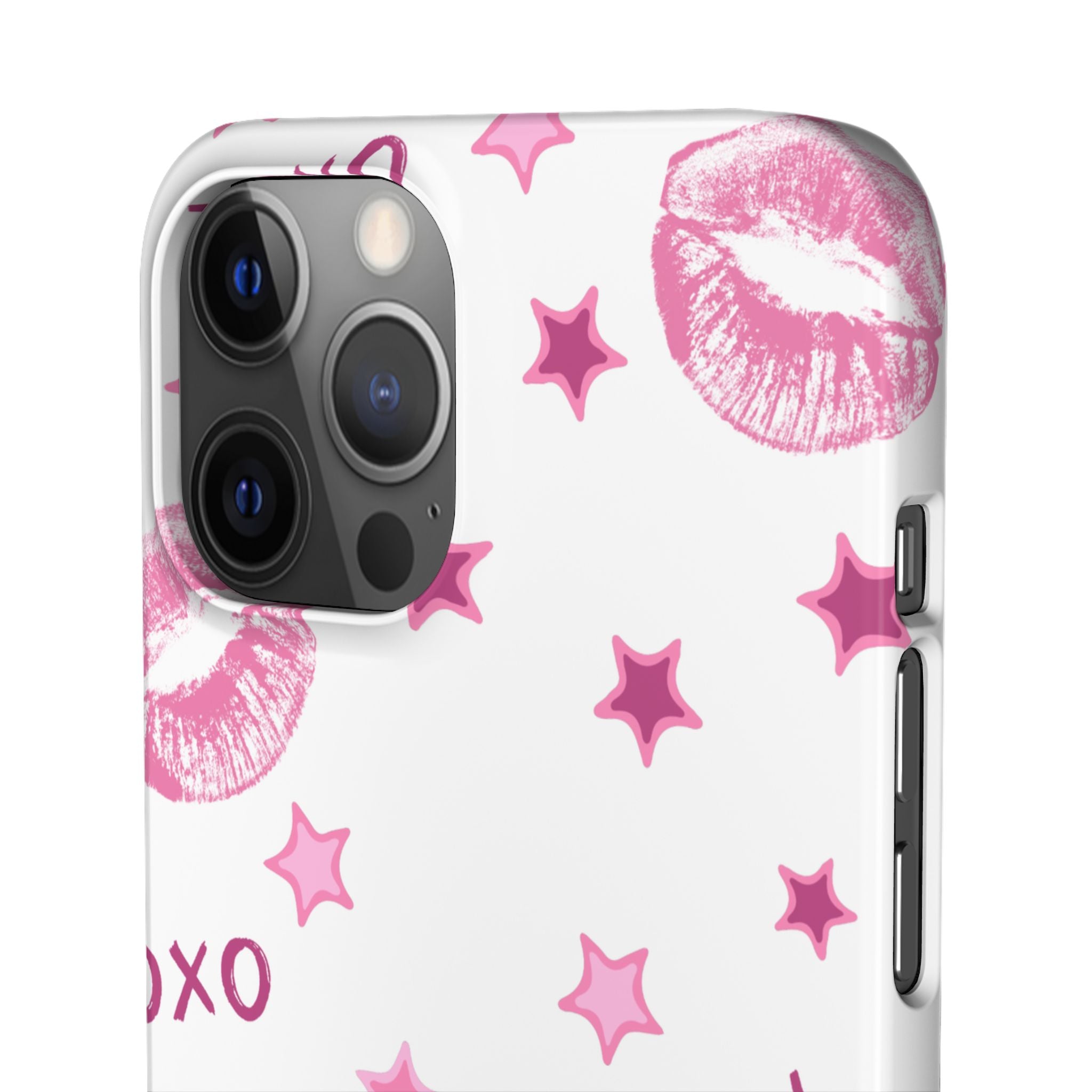 Kisses & Stars Snap Phone Case 💋