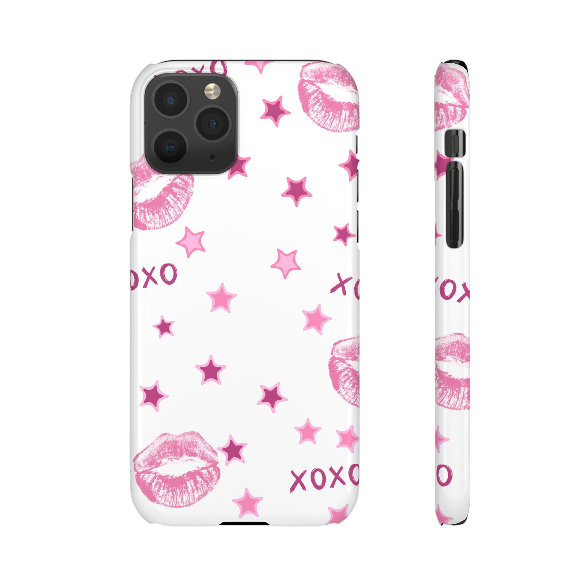 Kisses & Stars Snap Phone Case 💋