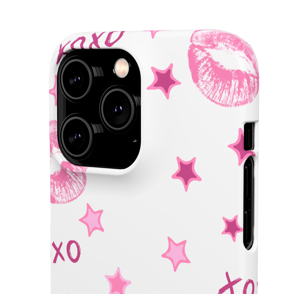 Kisses & Stars Snap Phone Case 💋