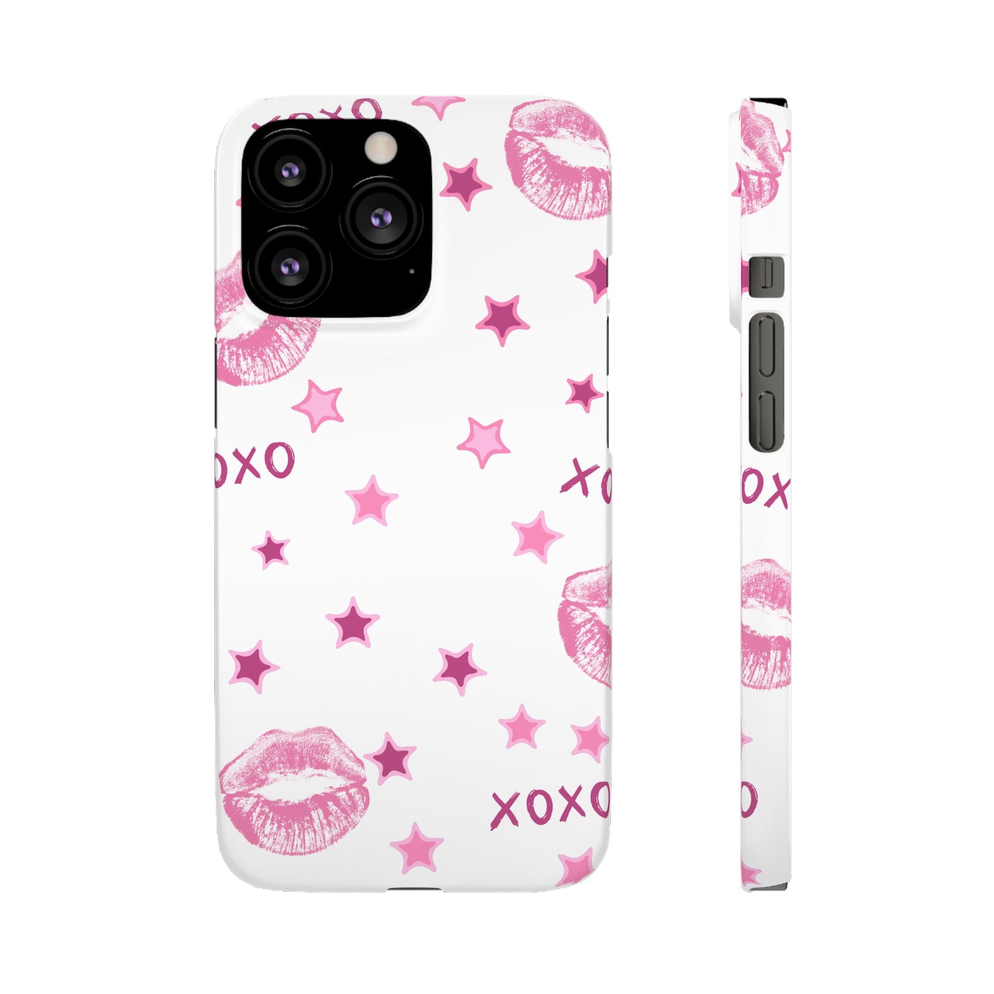 Kisses & Stars Snap Phone Case 💋