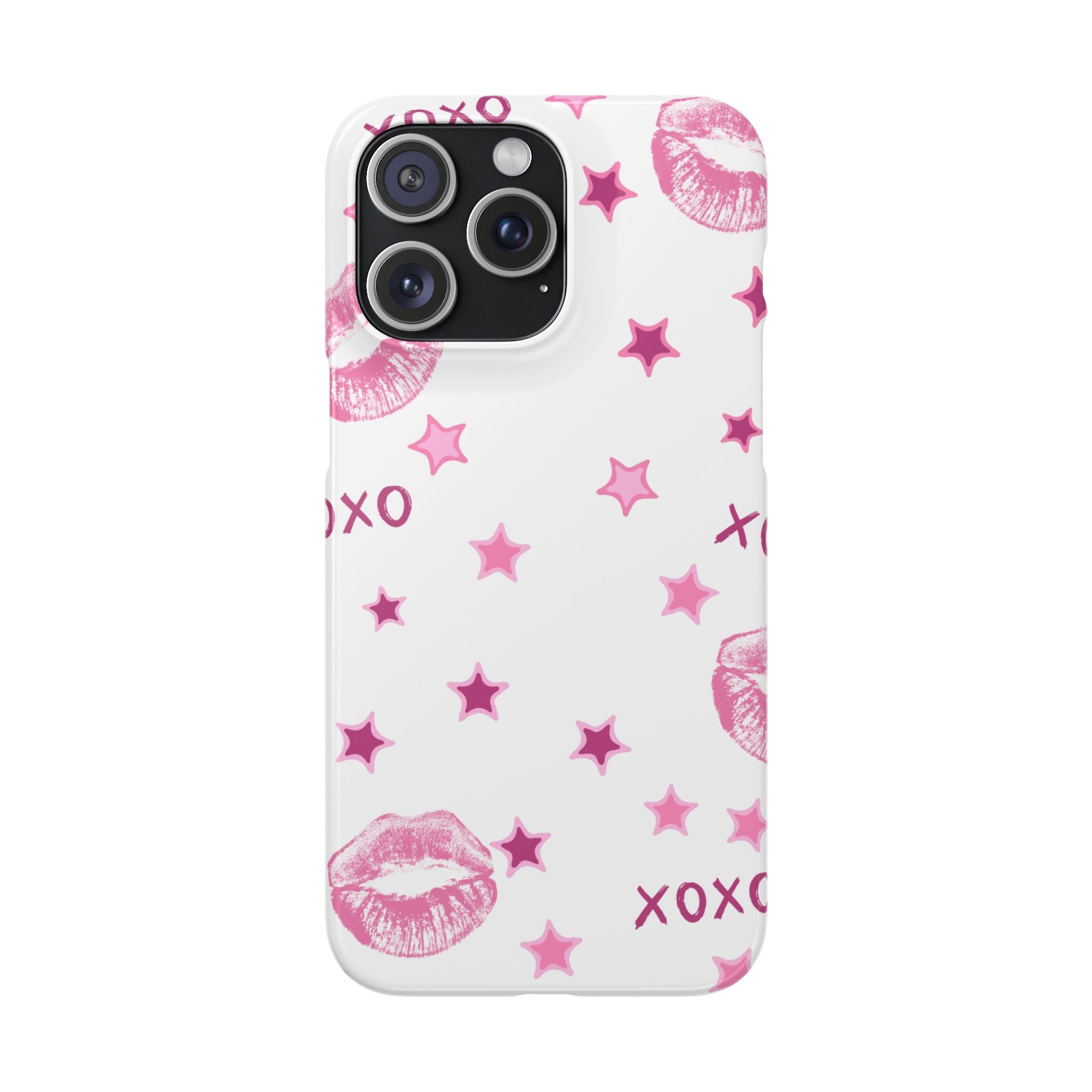 Kisses & Stars Snap Phone Case 💋