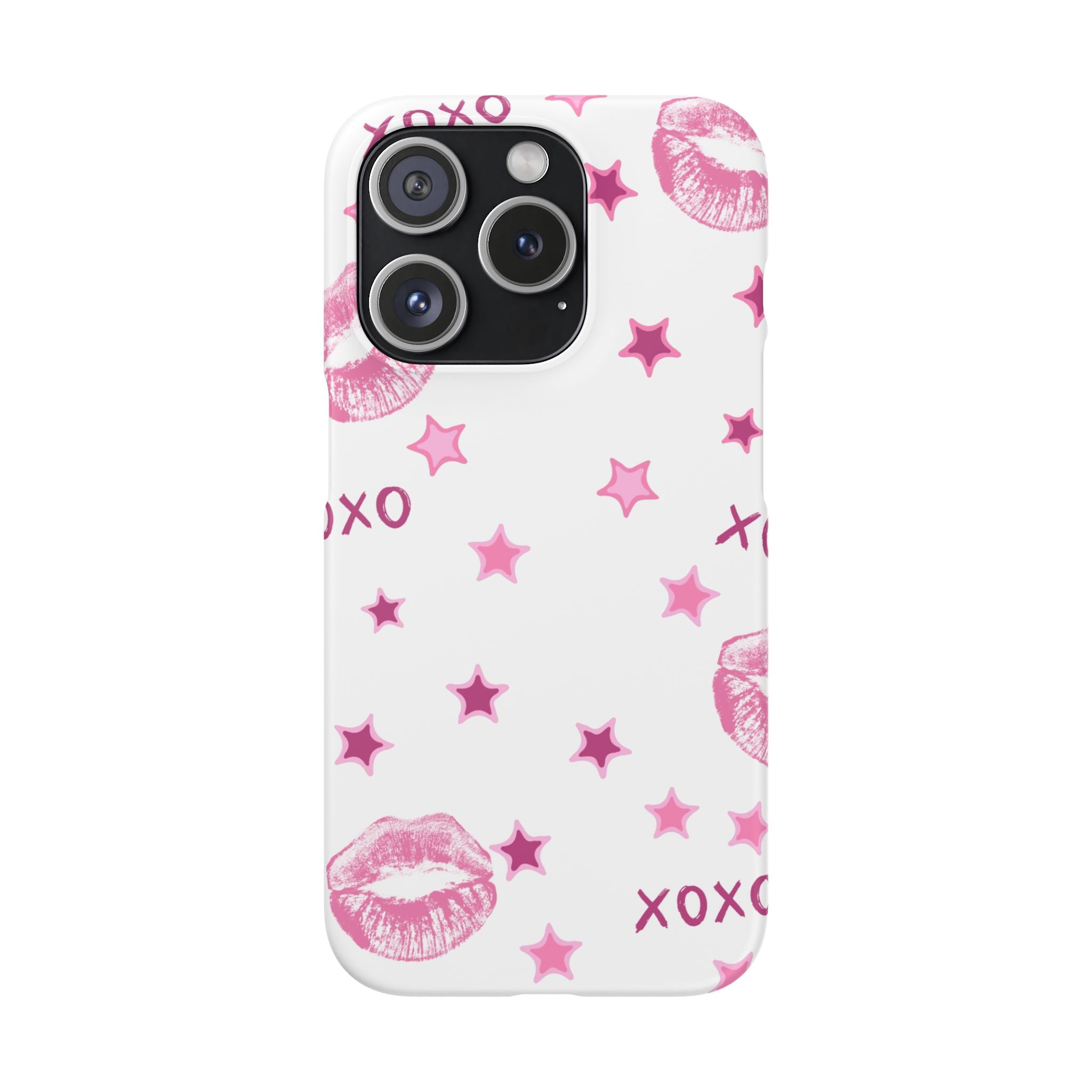Kisses & Stars Snap Phone Case 💋