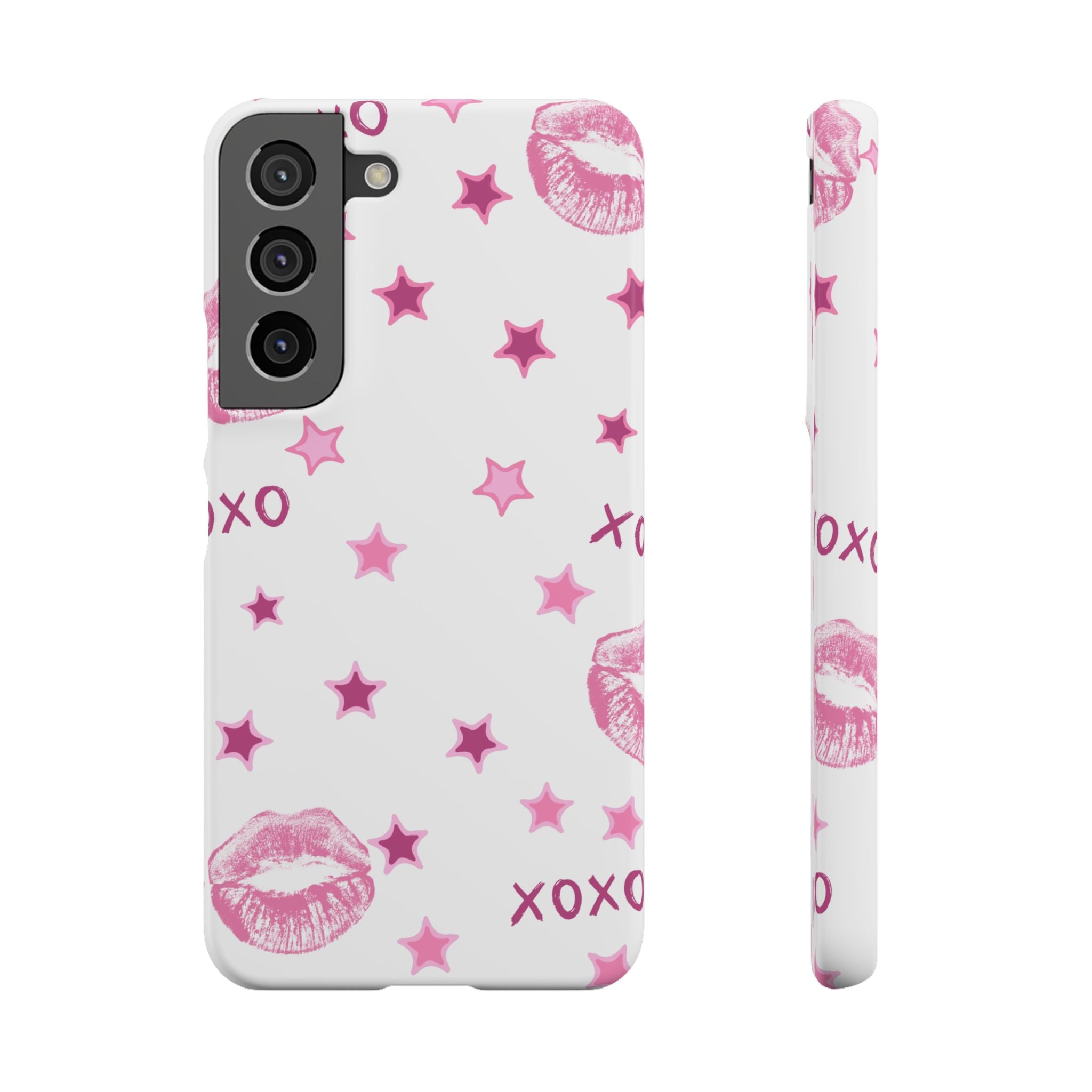 Kisses & Stars Snap Phone Case 💋
