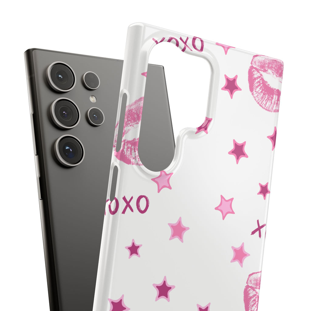 Kisses & Stars Snap Phone Case 💋