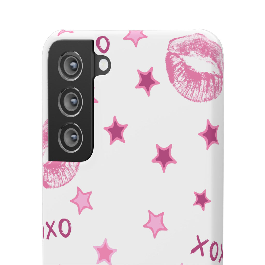 Kisses & Stars Snap Phone Case 💋
