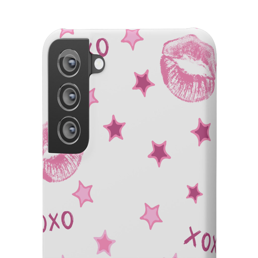 Kisses & Stars Snap Phone Case 💋