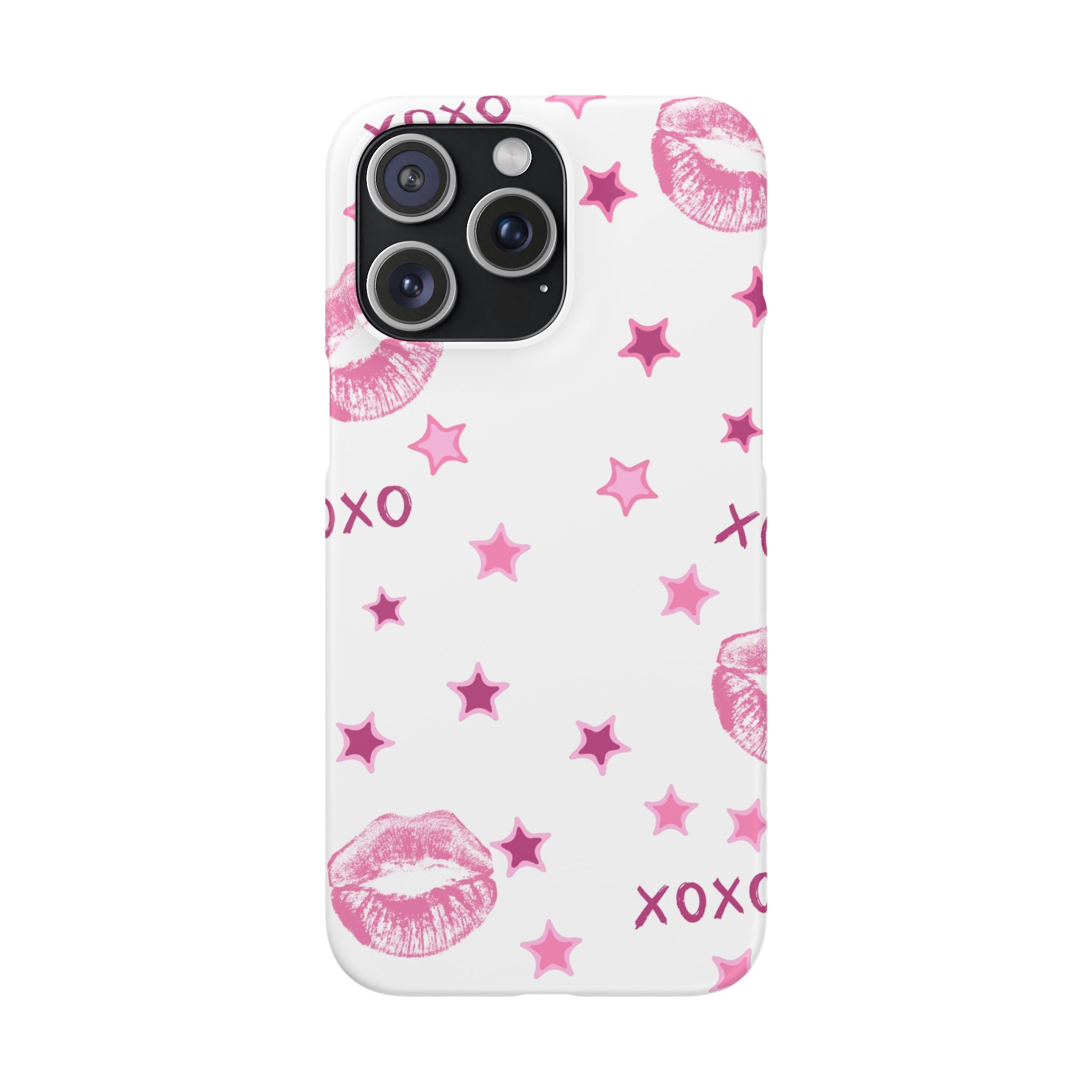 Kisses & Stars Snap Phone Case 💋