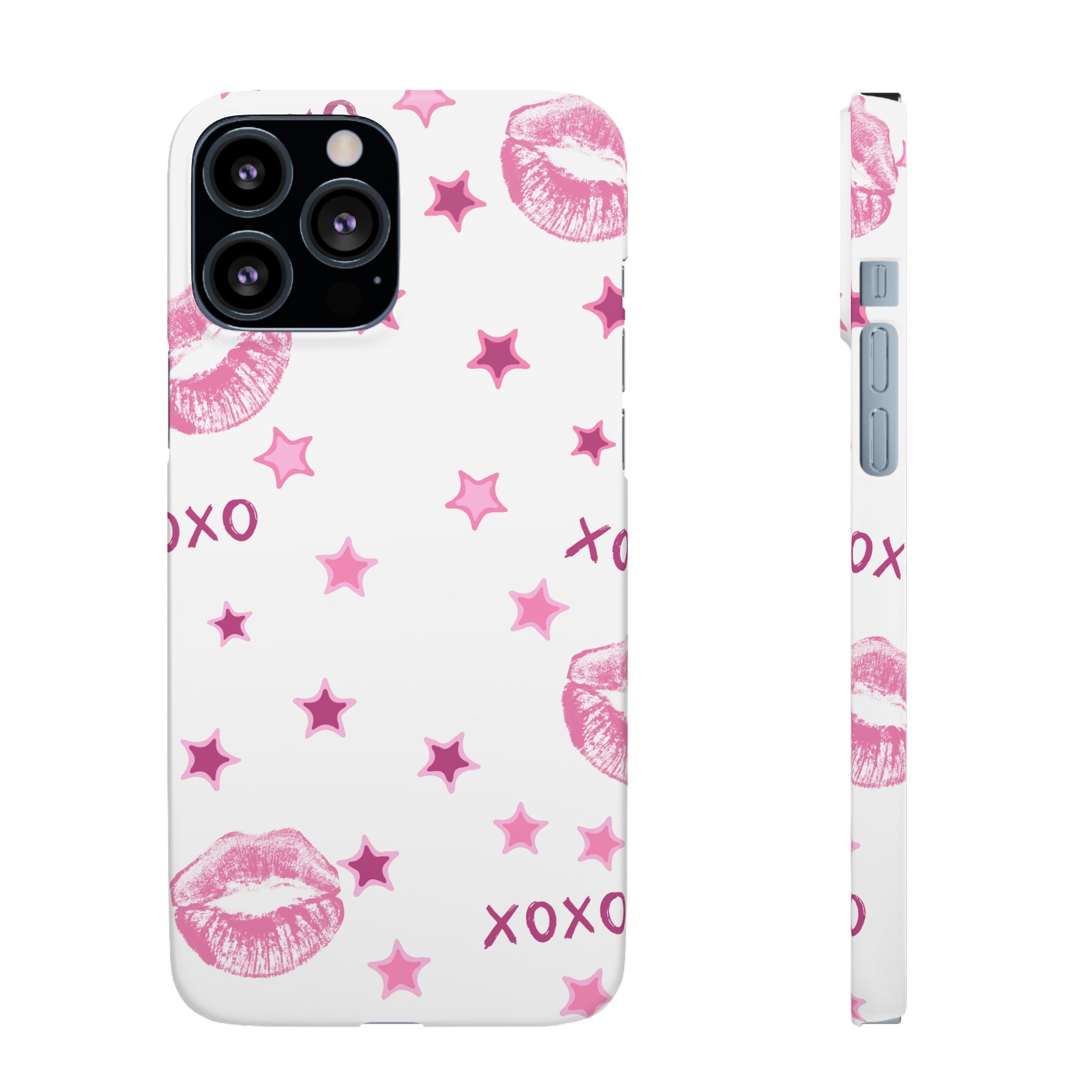 Kisses & Stars Snap Phone Case 💋