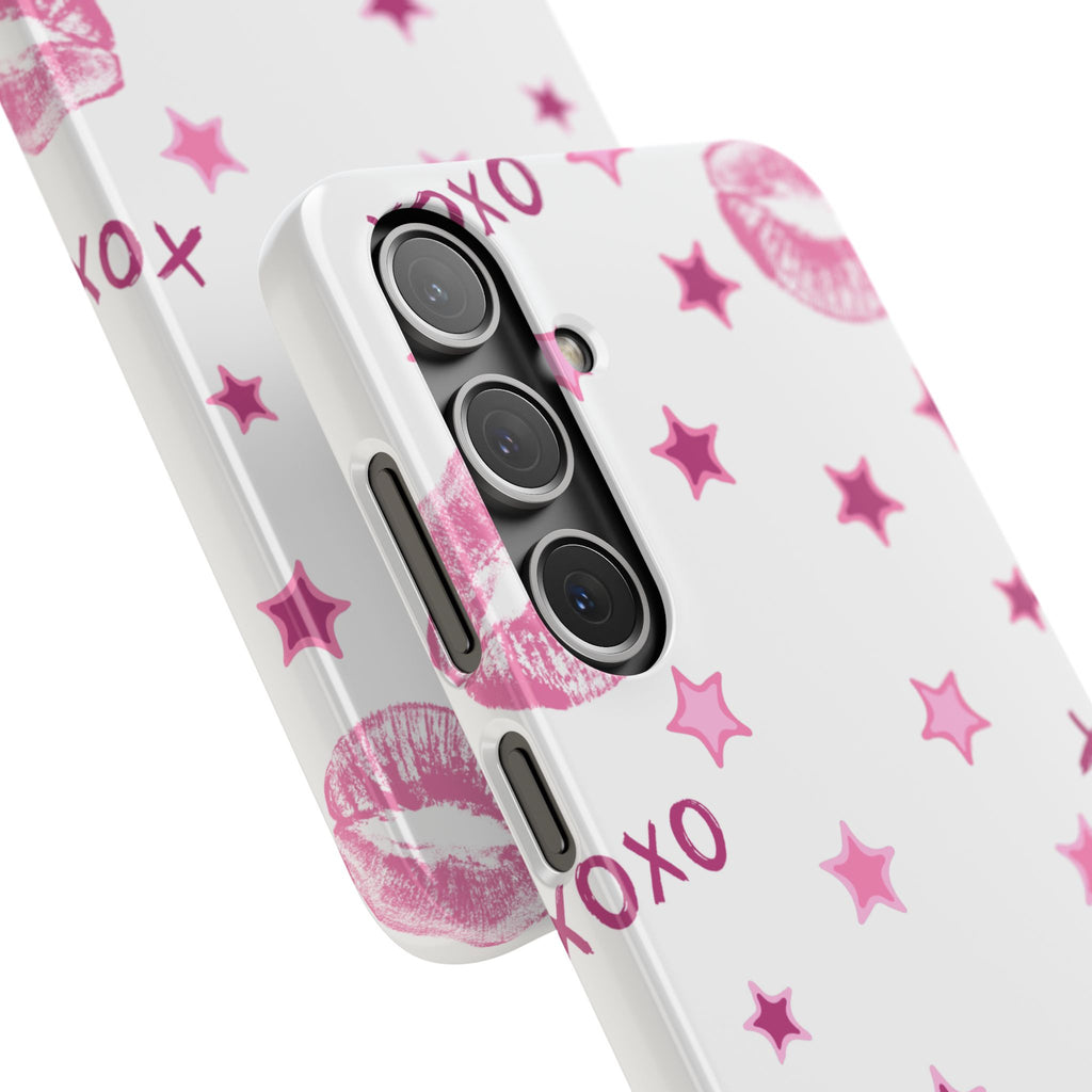 Kisses & Stars Snap Phone Case 💋