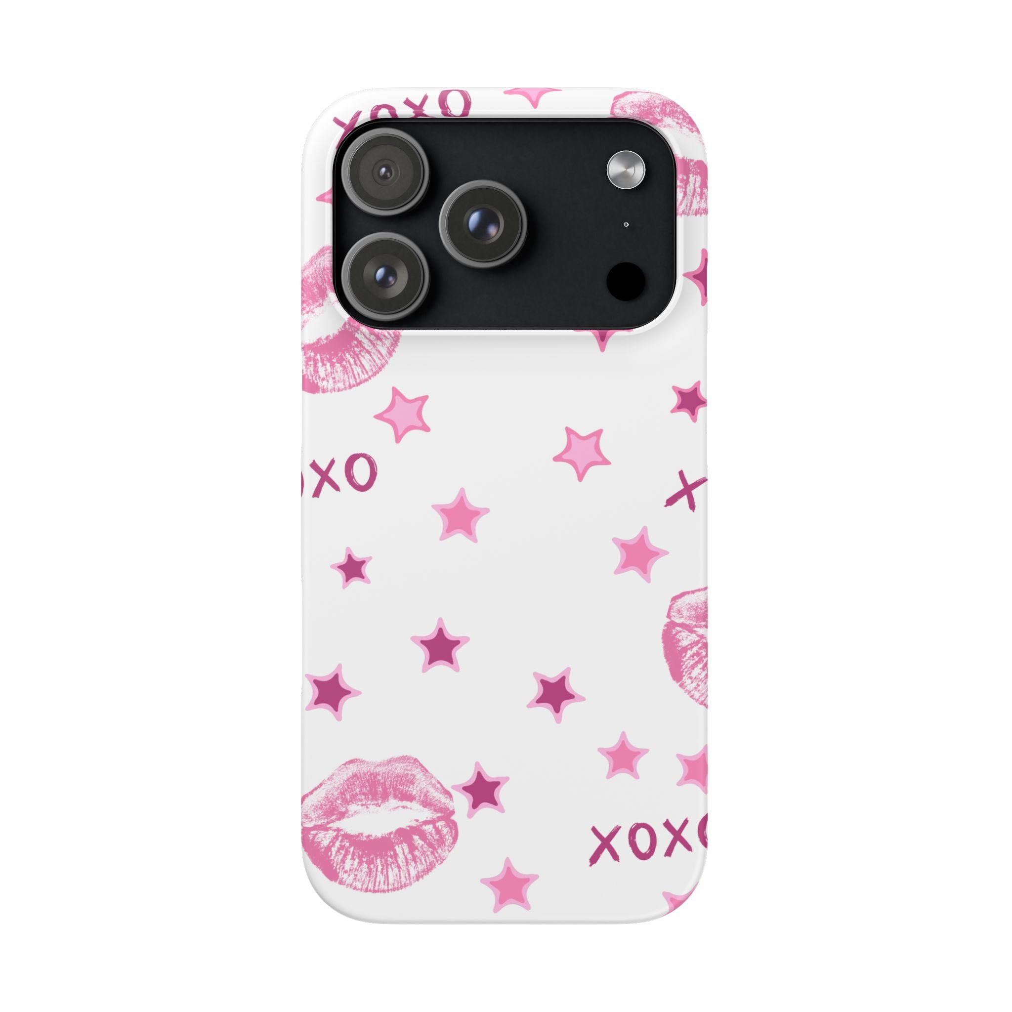 Kisses & Stars Snap Phone Case 💋