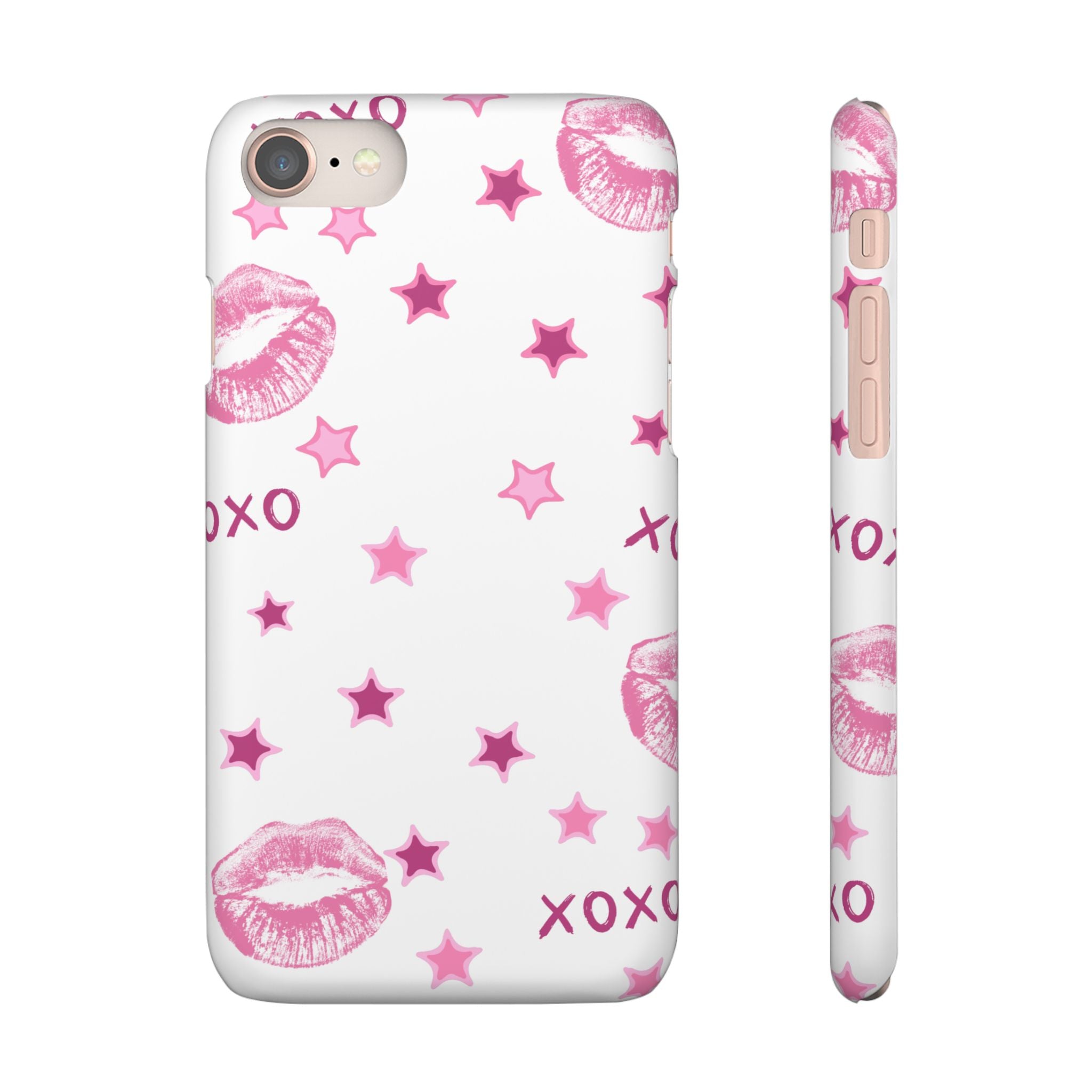 Kisses & Stars Snap Phone Case 💋