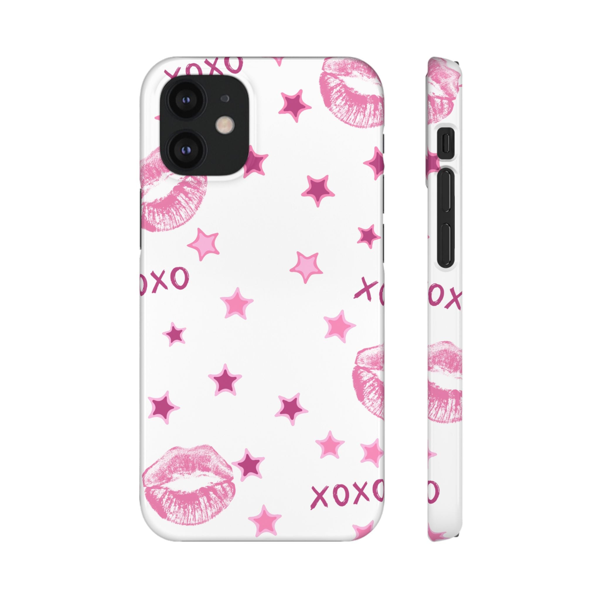 Kisses & Stars Snap Phone Case 💋