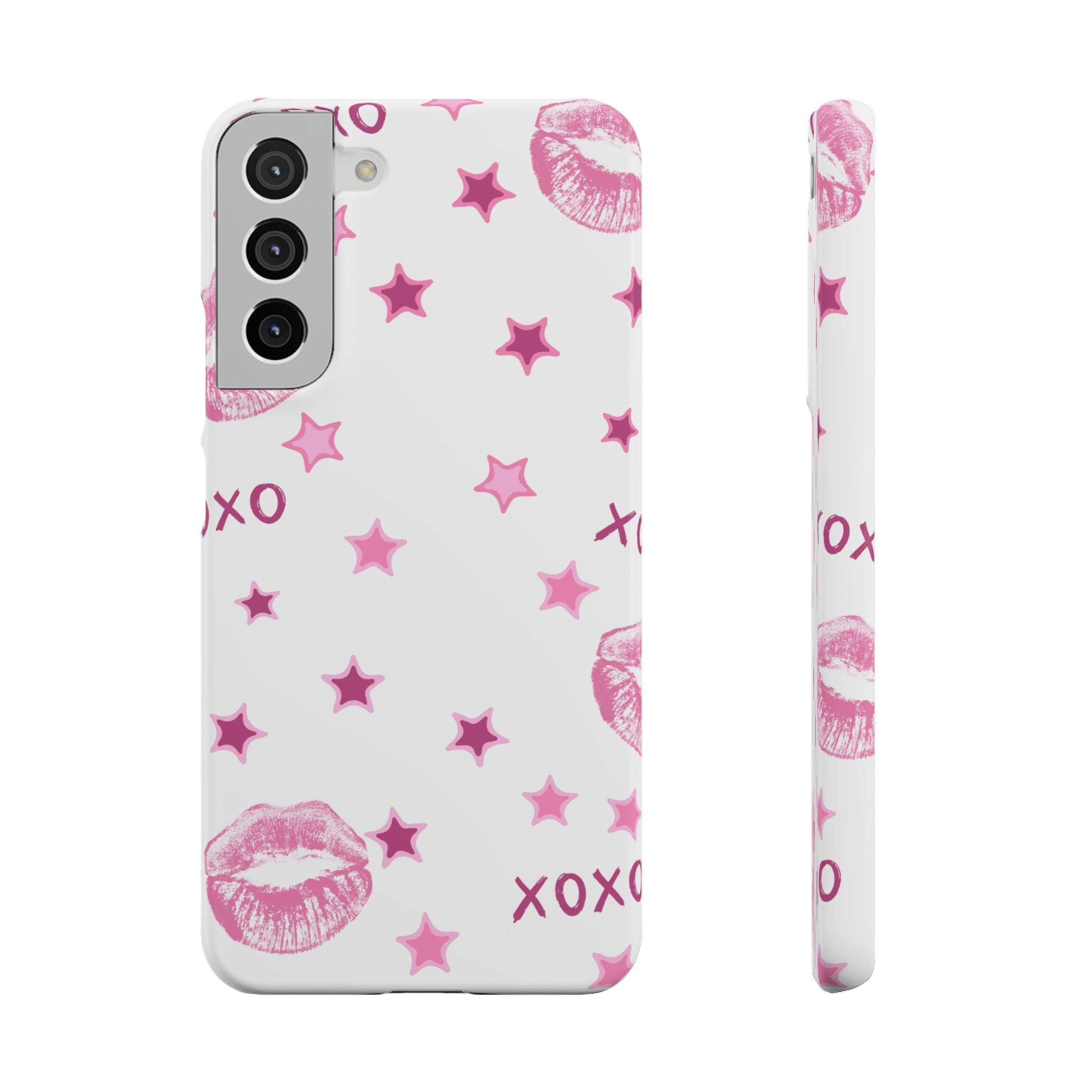 Kisses & Stars Snap Phone Case 💋