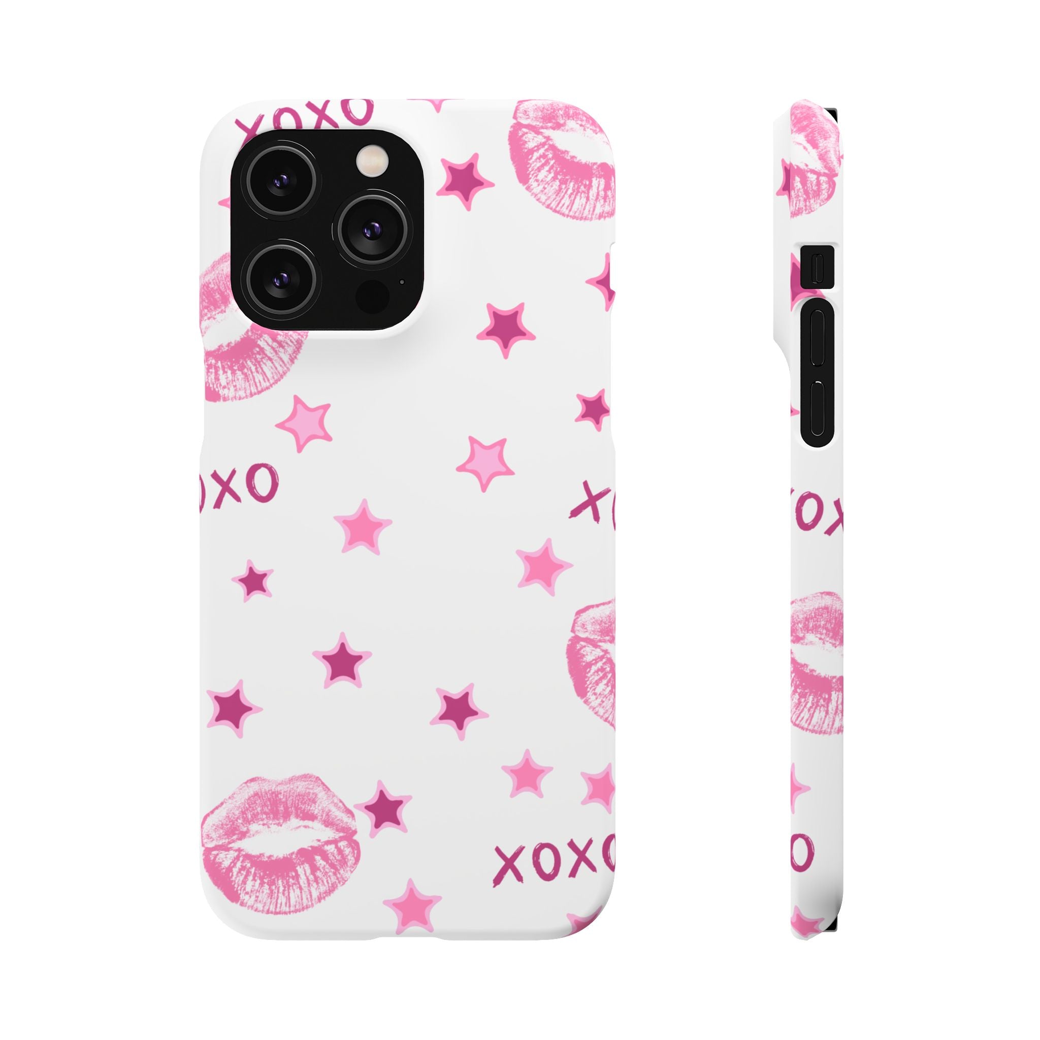 Kisses & Stars Snap Phone Case 💋