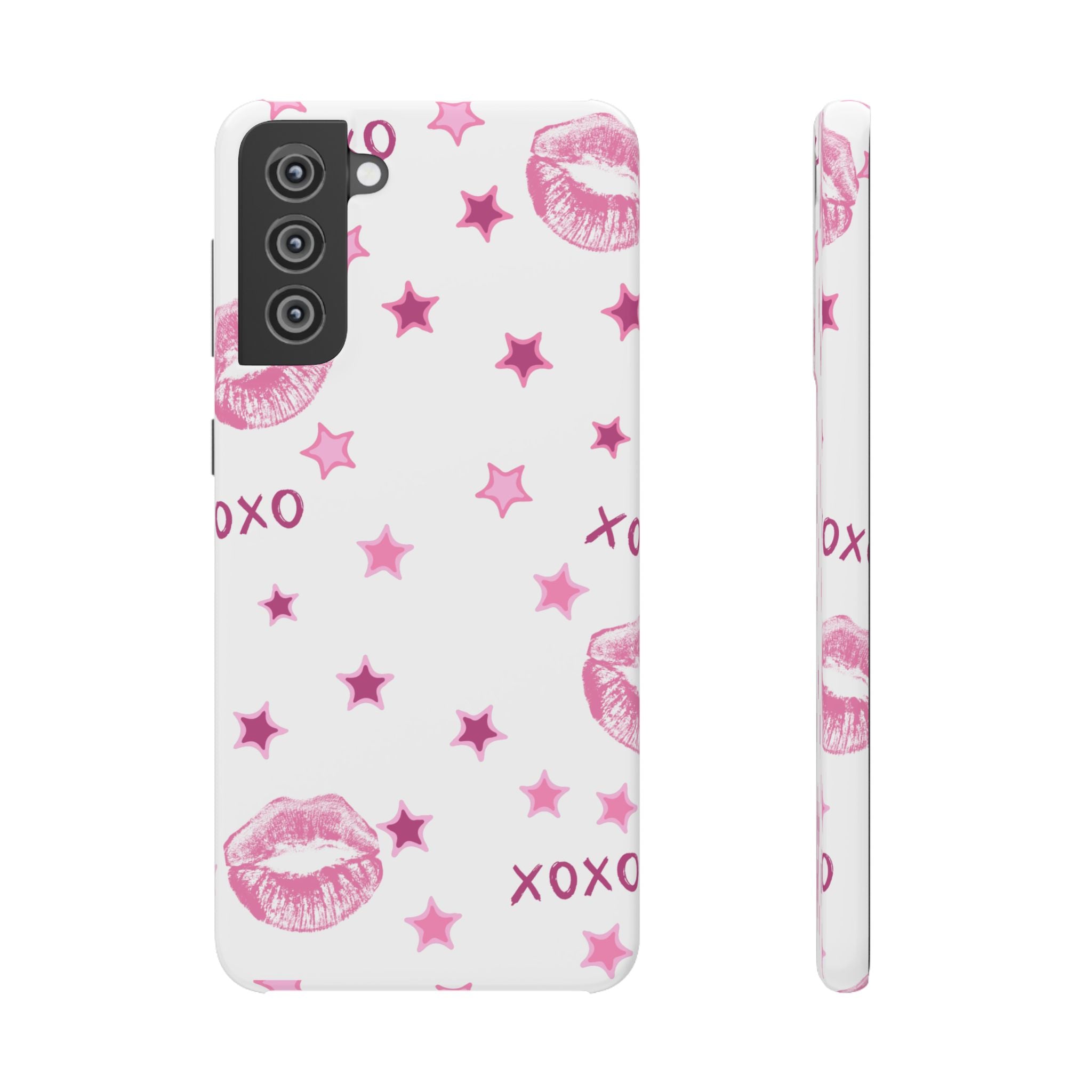Kisses & Stars Snap Phone Case 💋