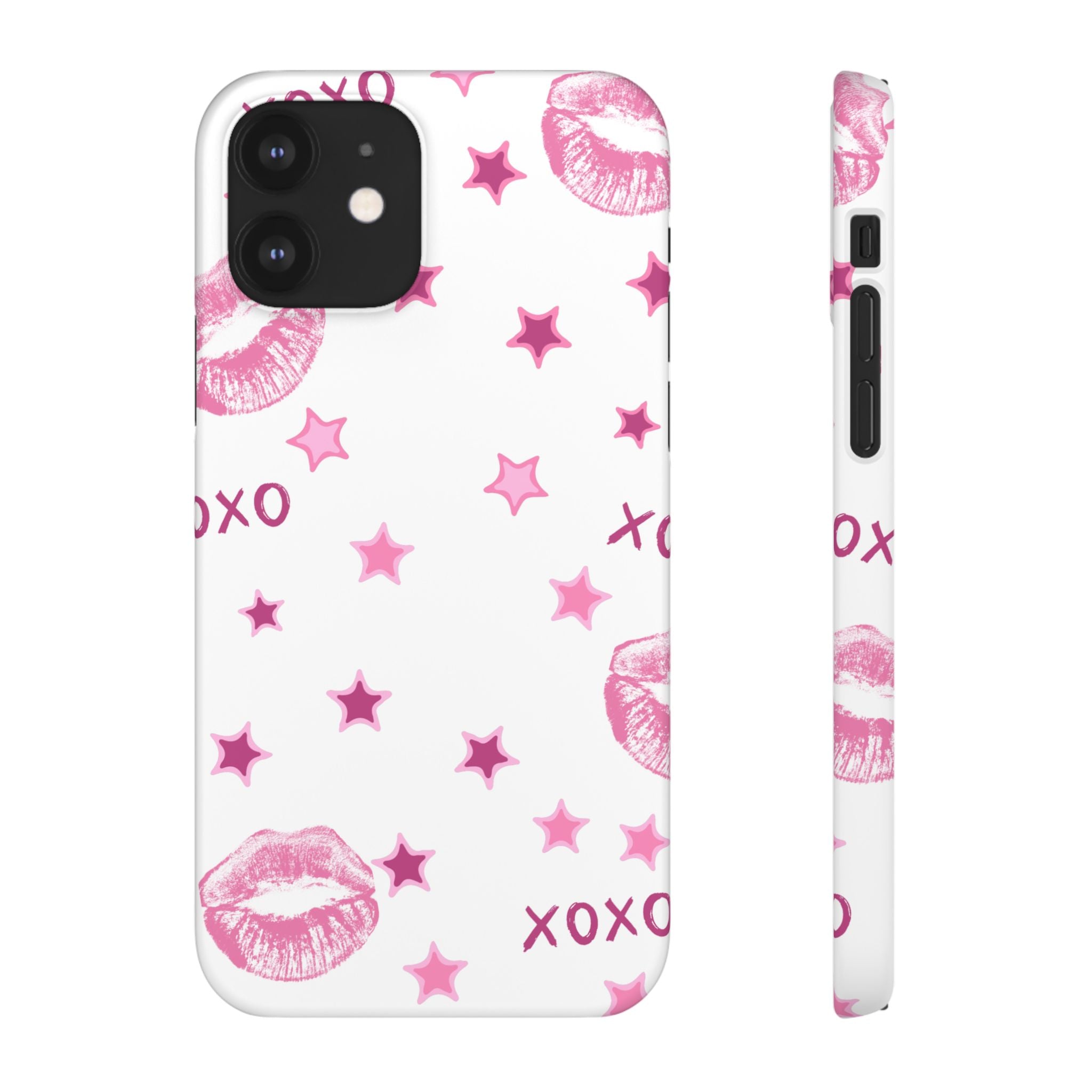 Kisses & Stars Snap Phone Case 💋