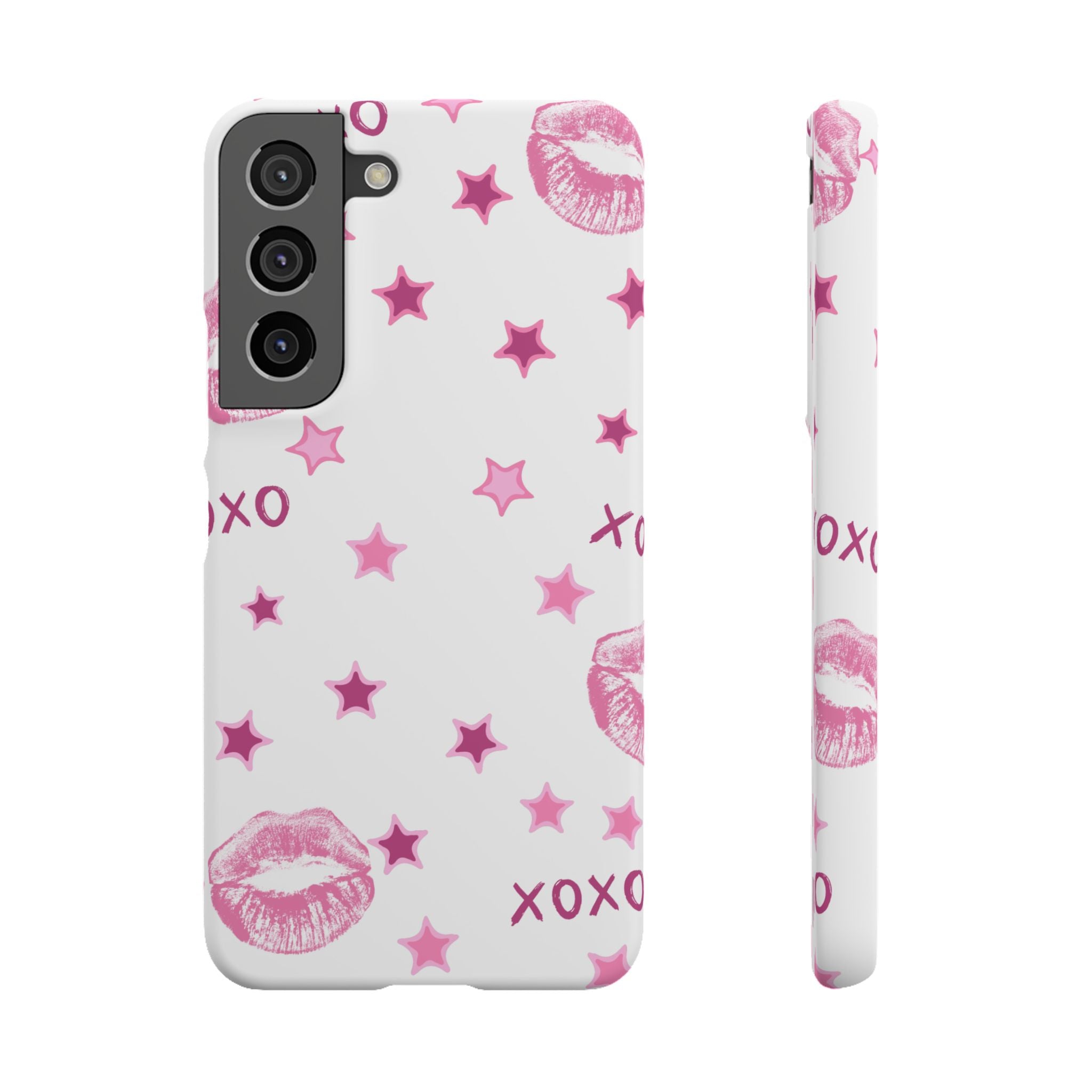 Kisses & Stars Snap Phone Case 💋
